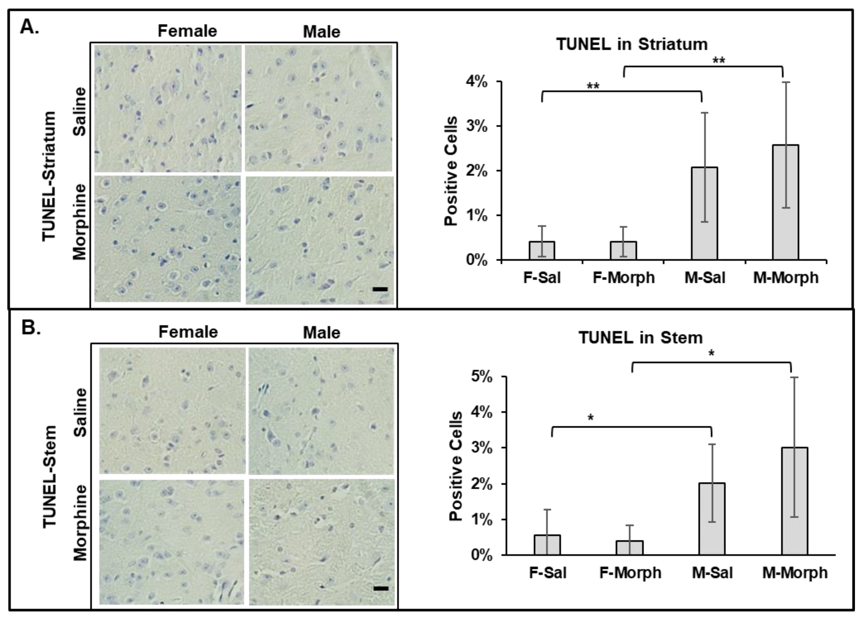 Pathophysiology 31 00012 g004 Pathophysiology 31 00012 g004