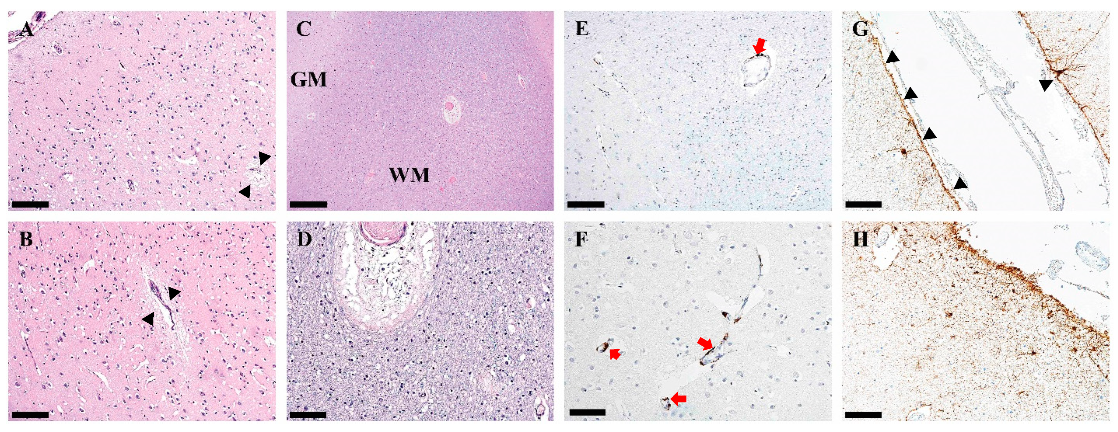 Pathophysiology 32 00003 g002