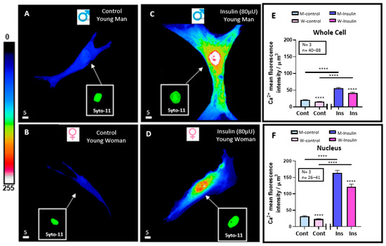 In Vitro Chronic Hyperinsulinemia Induces Remodelling of Vascular Smooth Muscle Cells from Young Men and Women in a Sex Hormone Independent Manner In Vitro Chronic Hyperinsulinemia Induces Remodelling of Vascular Smooth Muscle Cells from Young Men and Women in a Sex Hormone Independent Manner