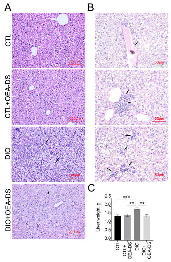 Hepatoprotective and Antiatherosclerotic Effects of Oleoylethanolamide ...