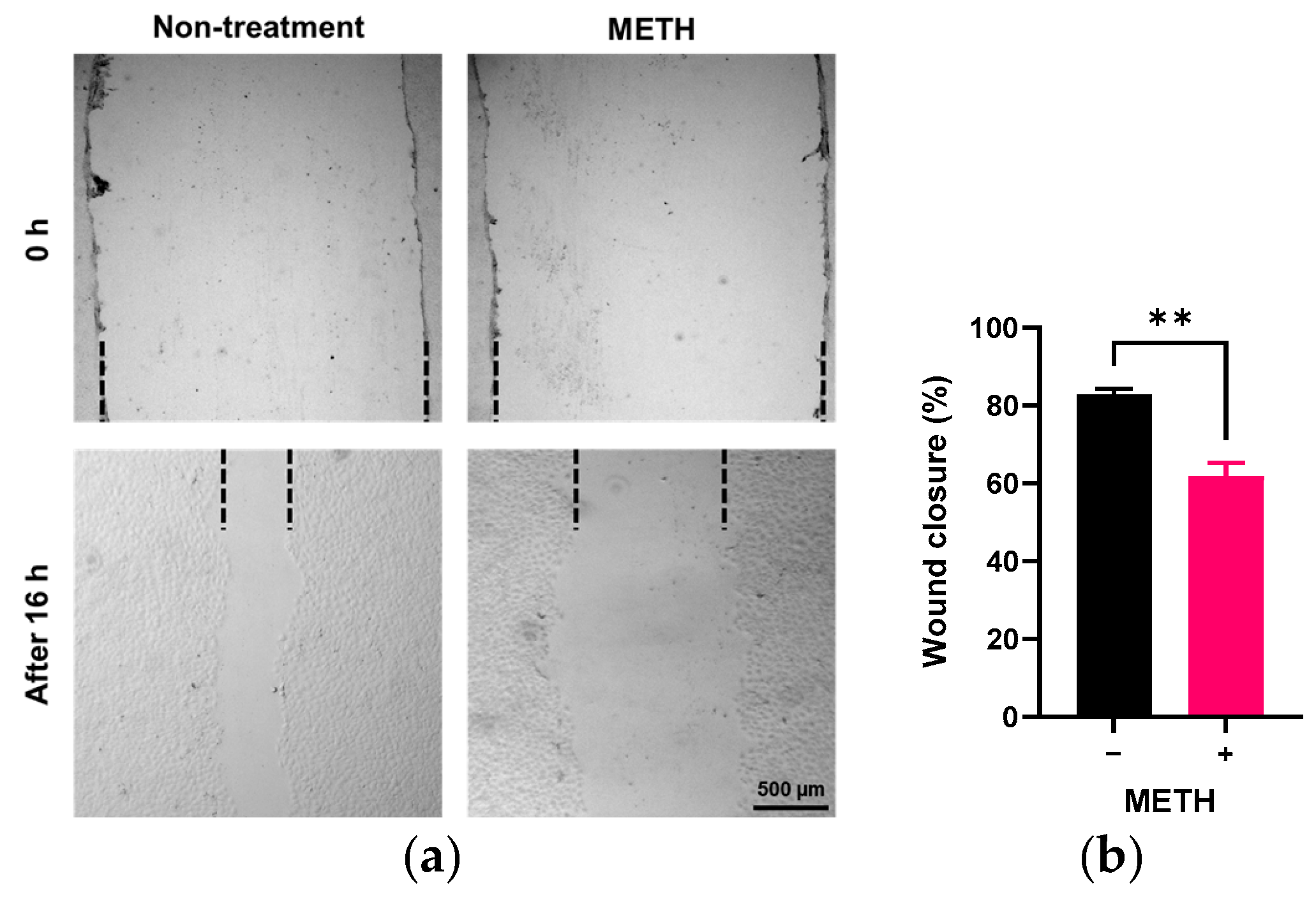 Pathophysiology 32 00041 g002 Pathophysiology 32 00041 g002