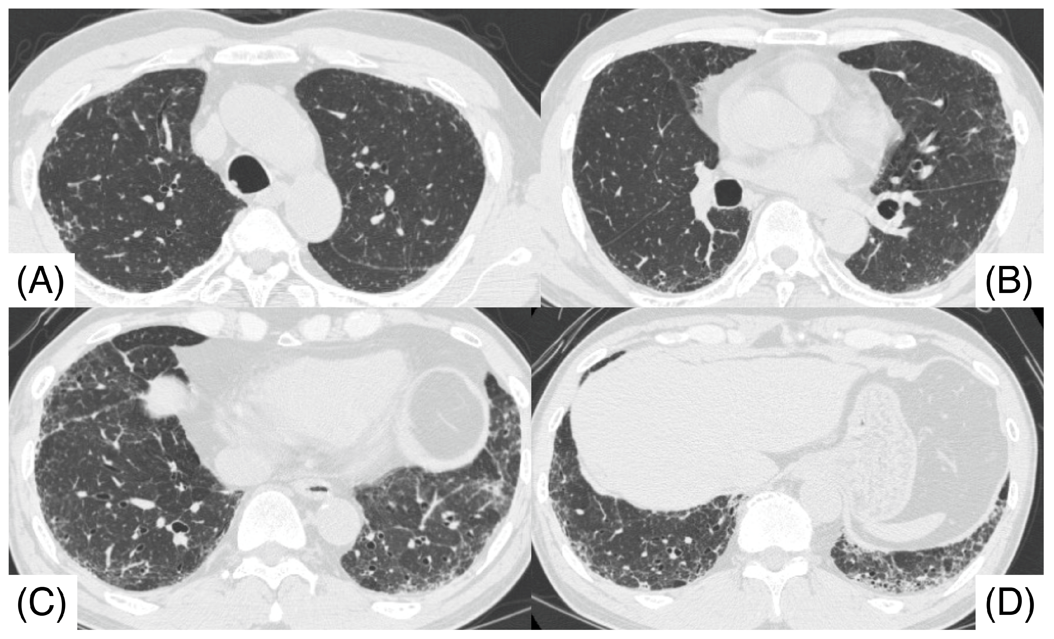 Pathophysiology 32 00047 g001 Pathophysiology 32 00047 g001