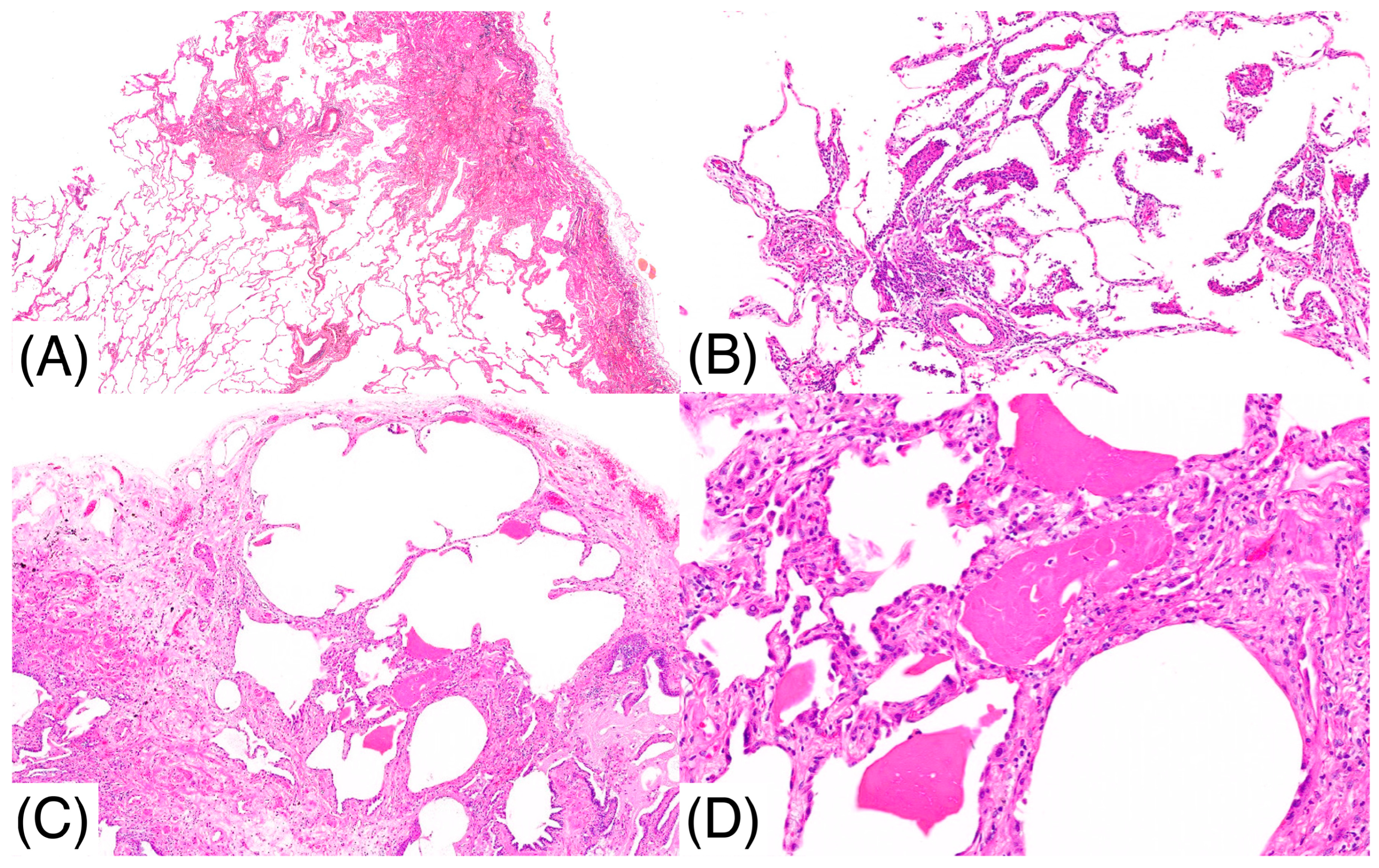Pathophysiology 32 00047 g004 Pathophysiology 32 00047 g004