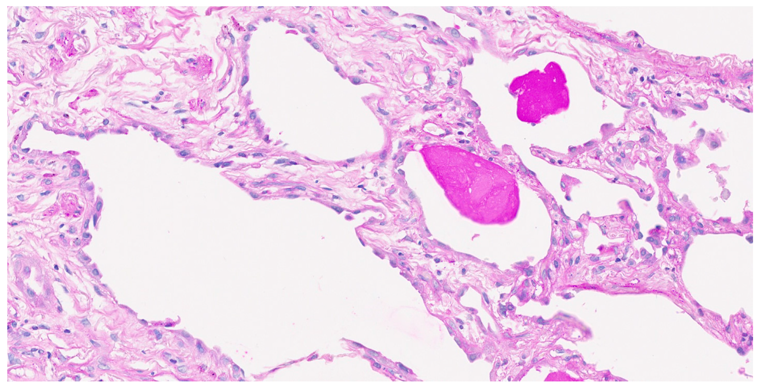 Pathophysiology 32 00047 g005 Pathophysiology 32 00047 g005