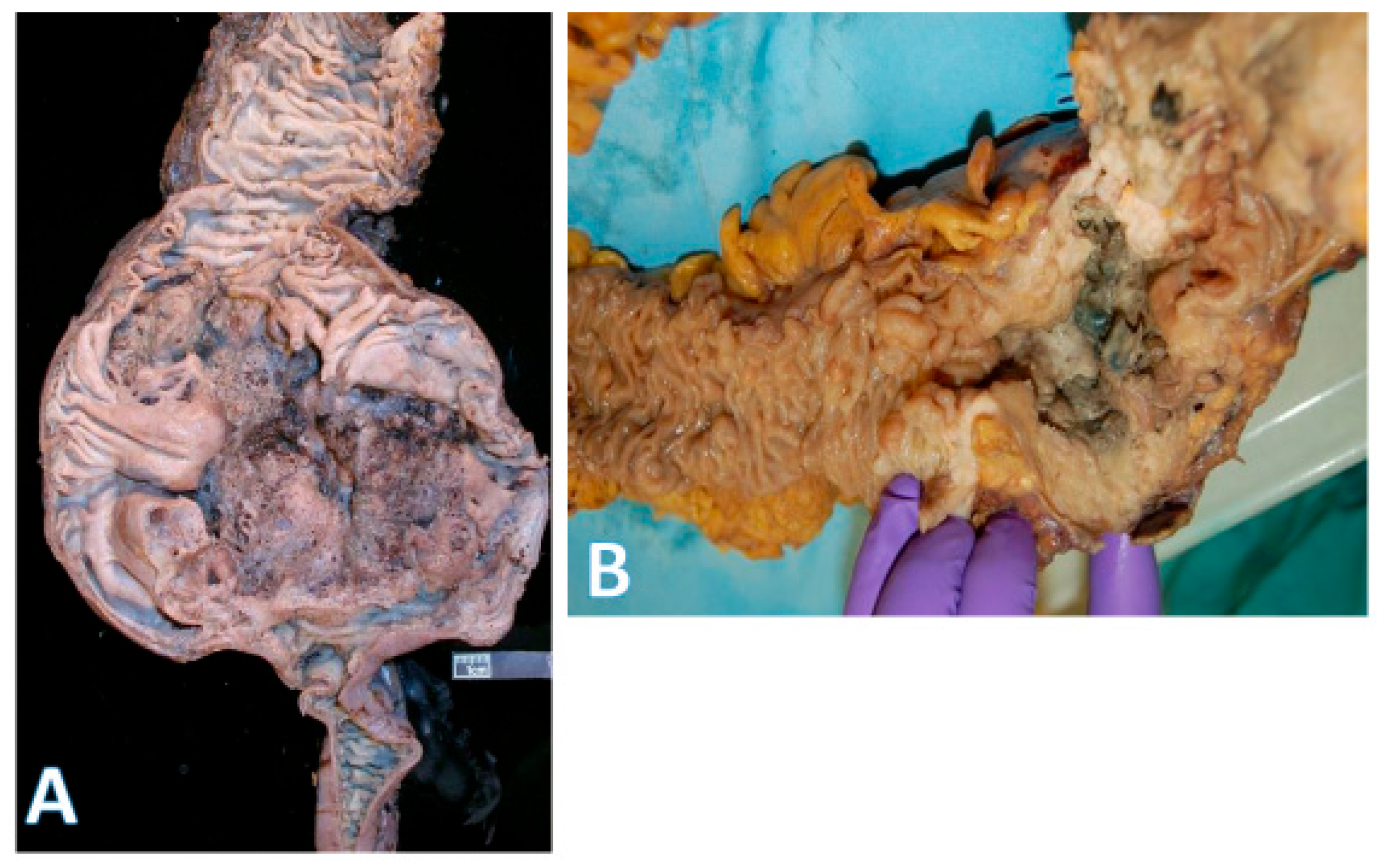 Pathophysiology 32 00052 g003 Pathophysiology 32 00052 g003