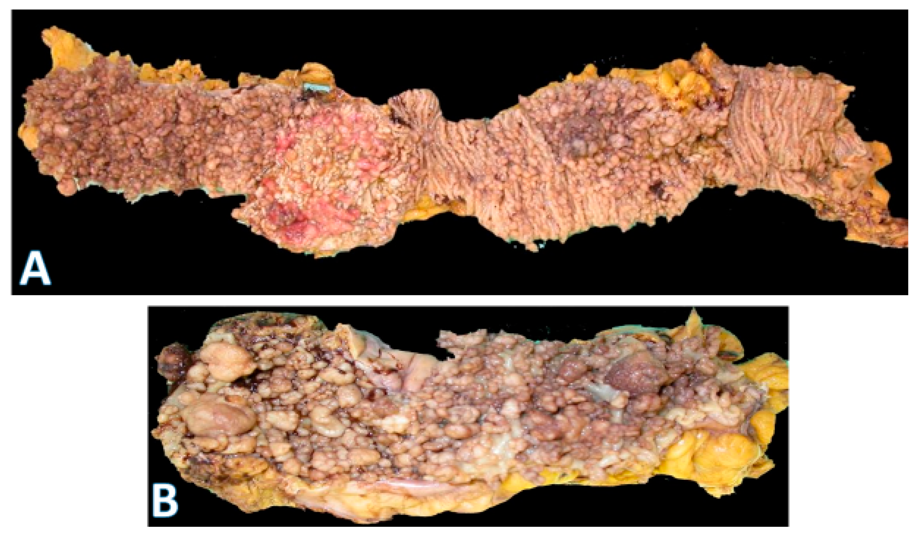 Pathophysiology 32 00052 g006 Pathophysiology 32 00052 g006