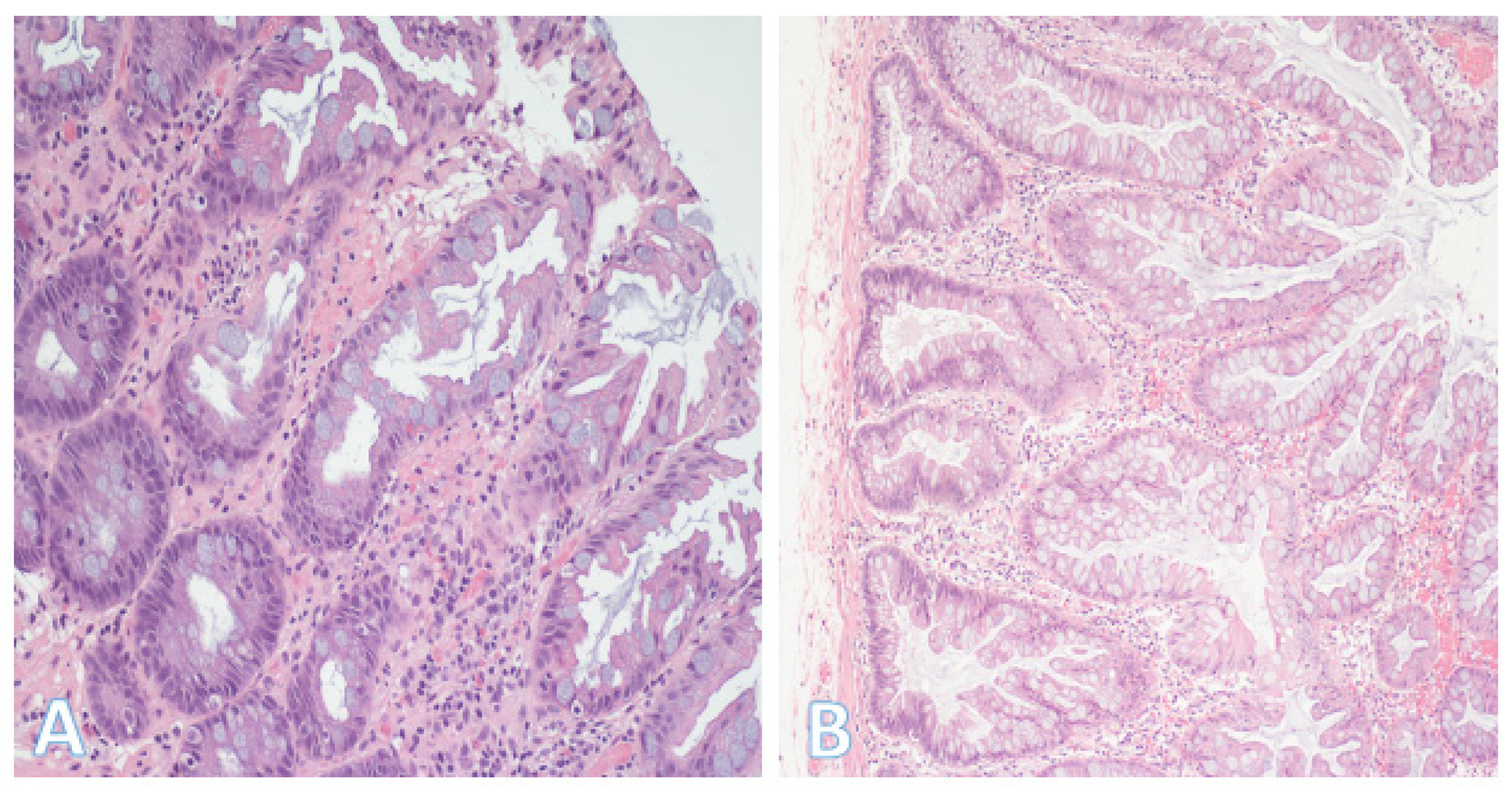 Pathophysiology 32 00052 g007 Pathophysiology 32 00052 g007