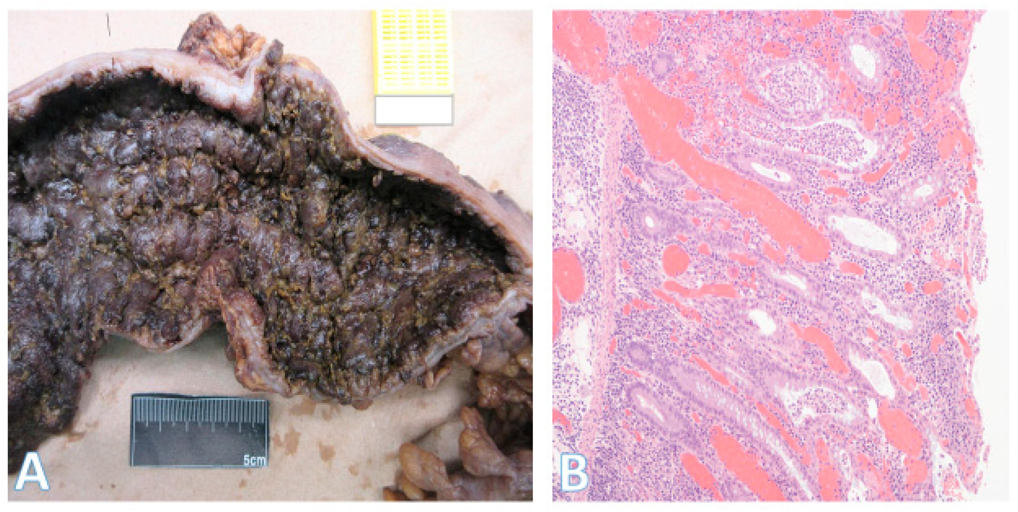 Pathophysiology 32 00052 g010 Pathophysiology 32 00052 g010