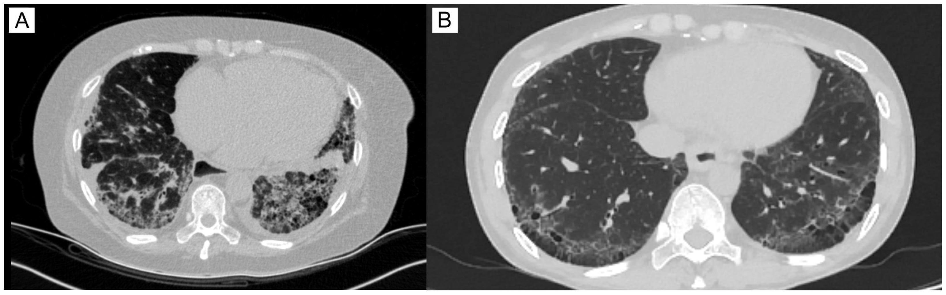 Pathophysiology 32 00057 g002