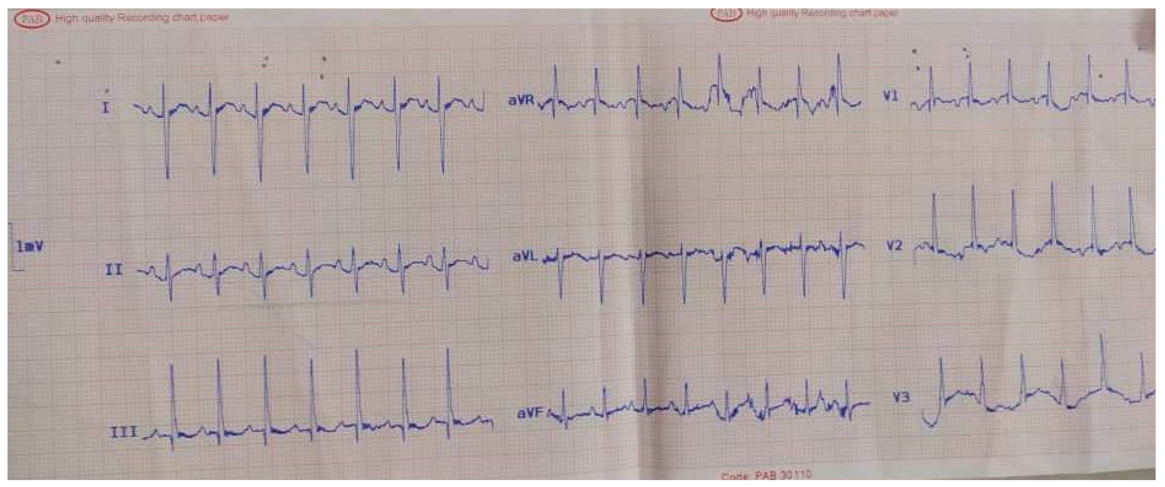 Pediatrrep 13 00007 g001