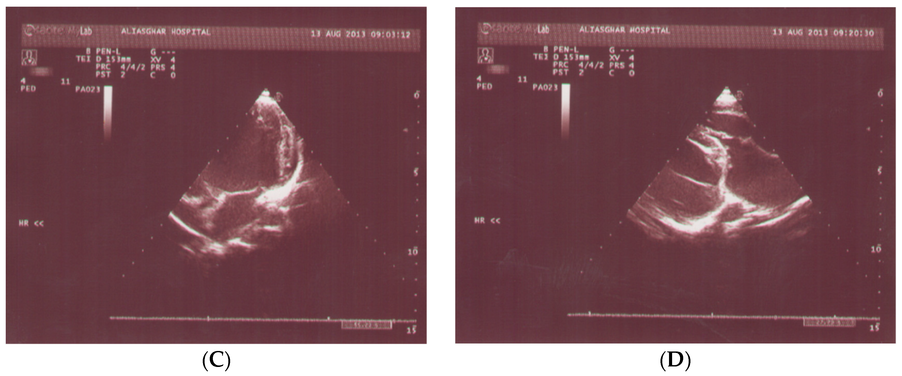 Pediatrrep 13 00007 g002b