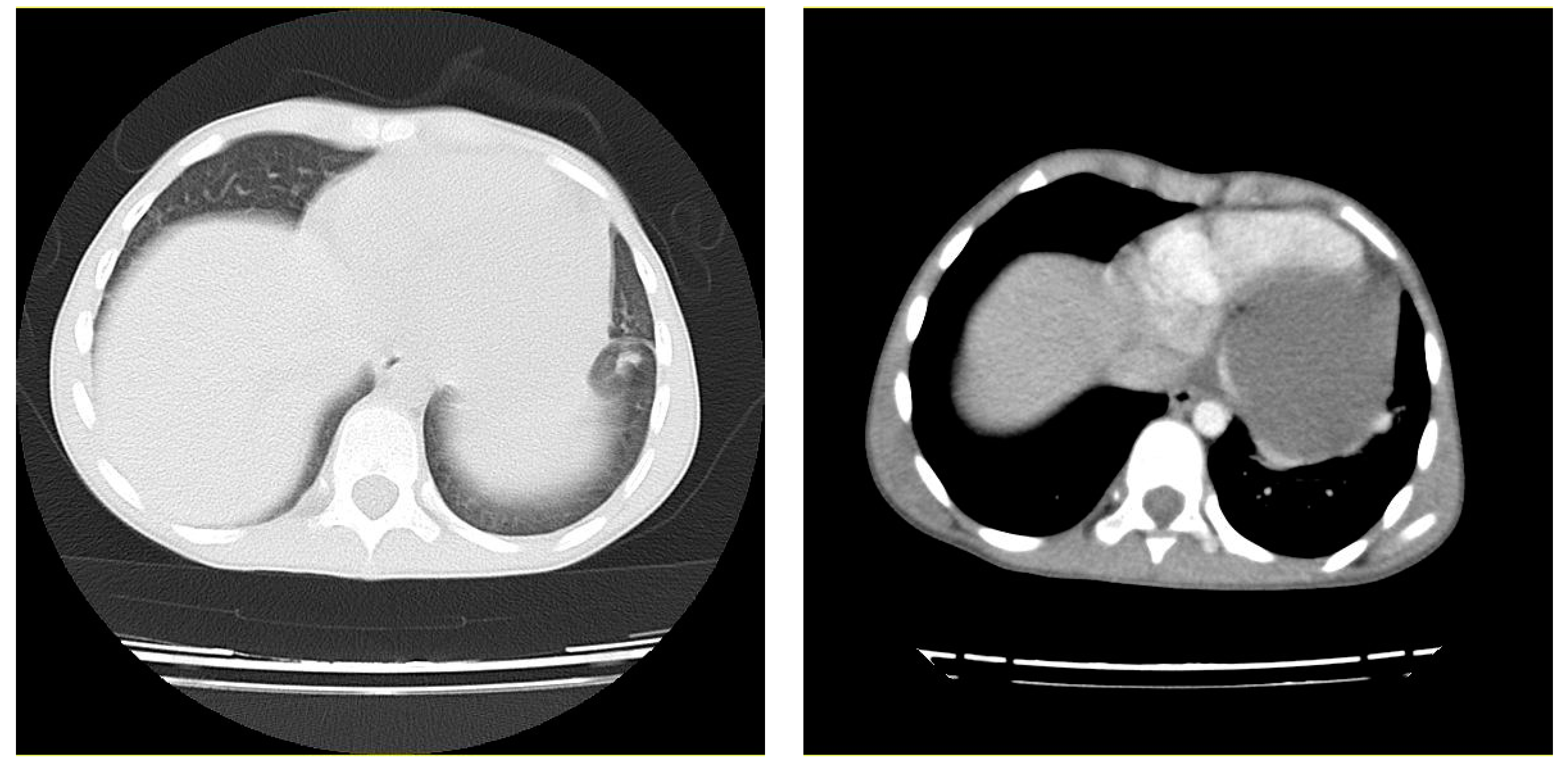Pediatrrep 13 00007 g003