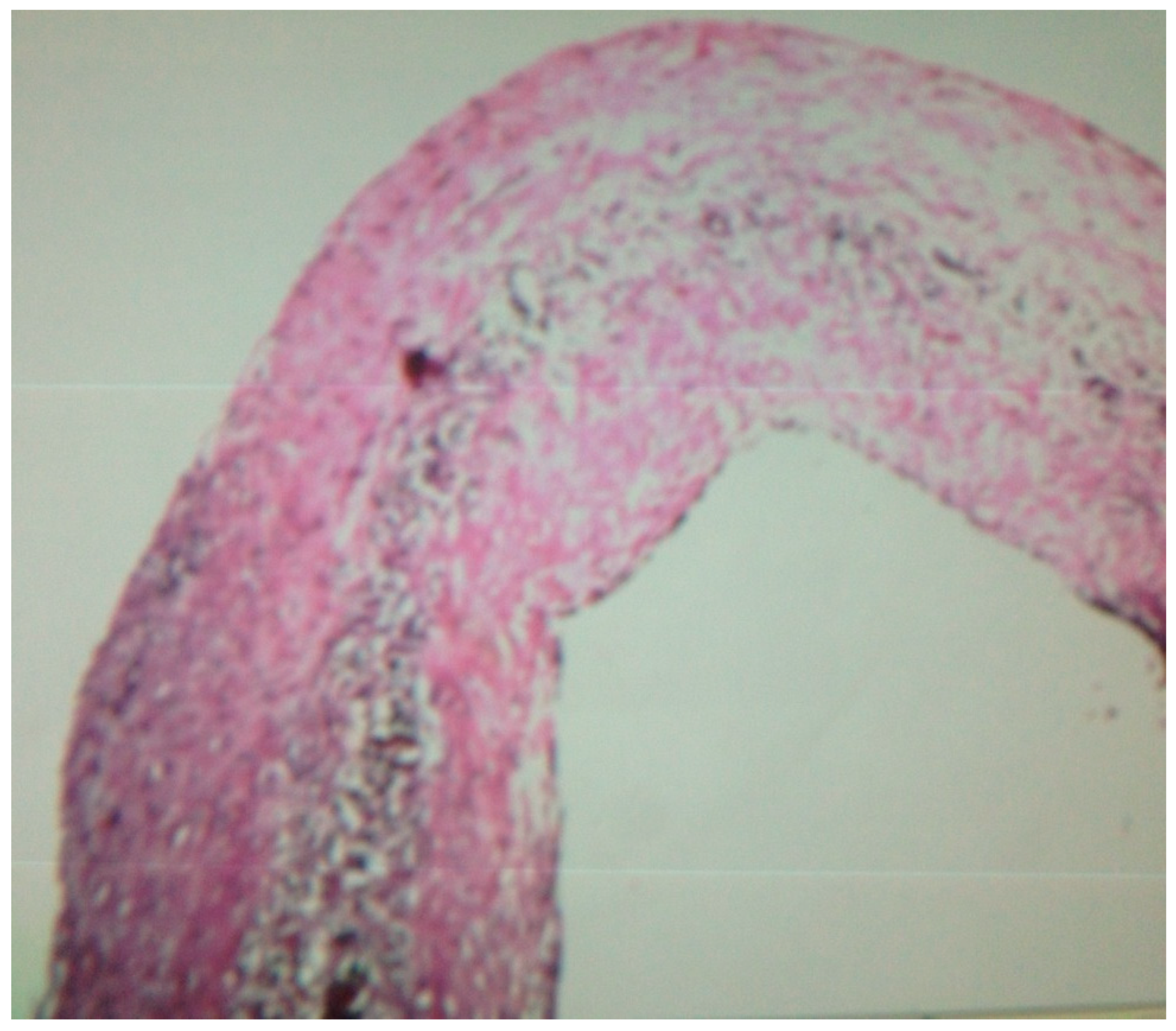 Pediatrrep 13 00007 g004