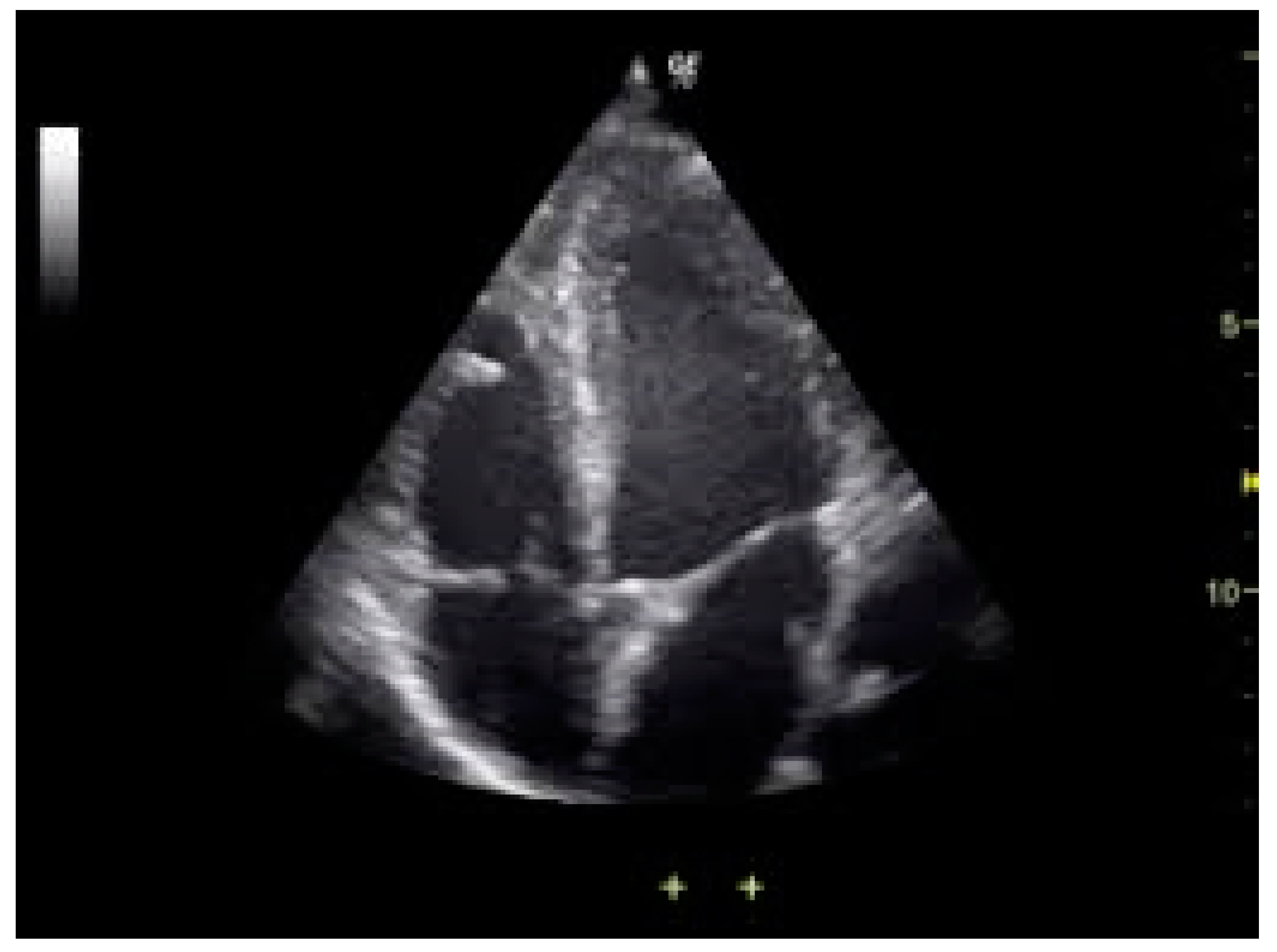 Pediatrrep 13 00007 g005