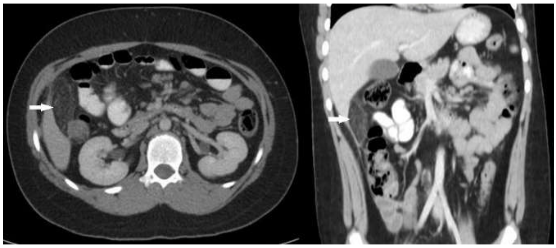 Pediatrrep 13 00010 g001