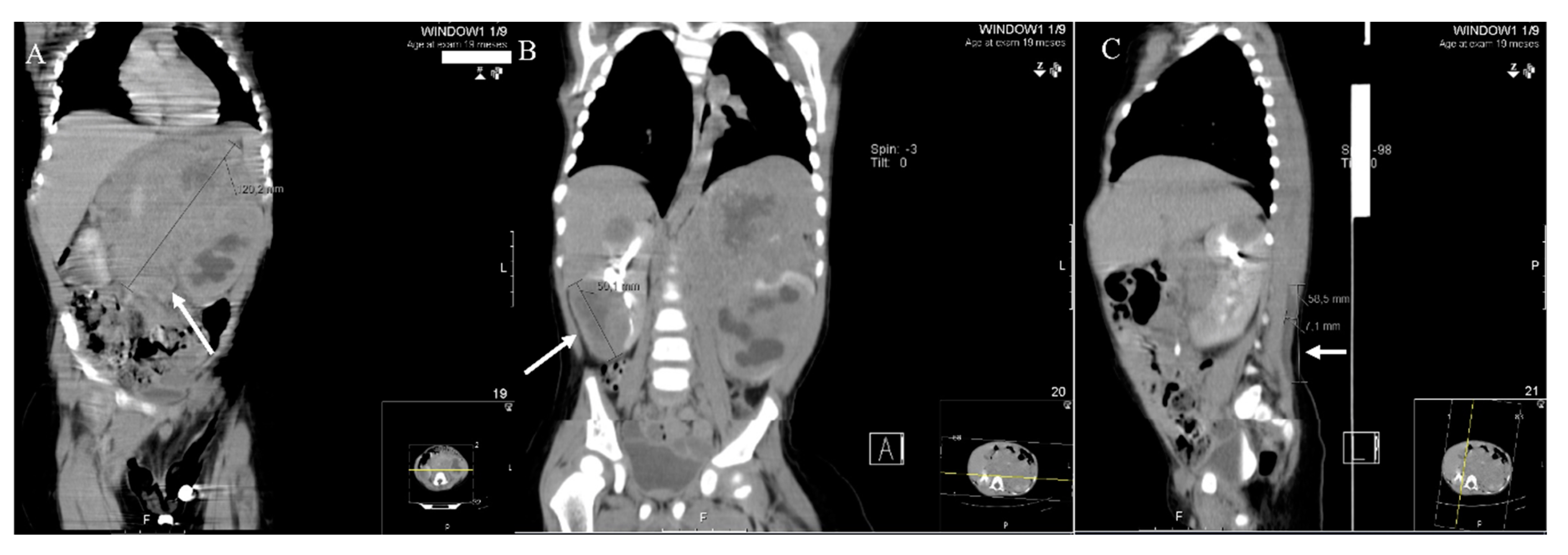 Pediatrrep 13 00018 g001 Pediatrrep 13 00018 g001