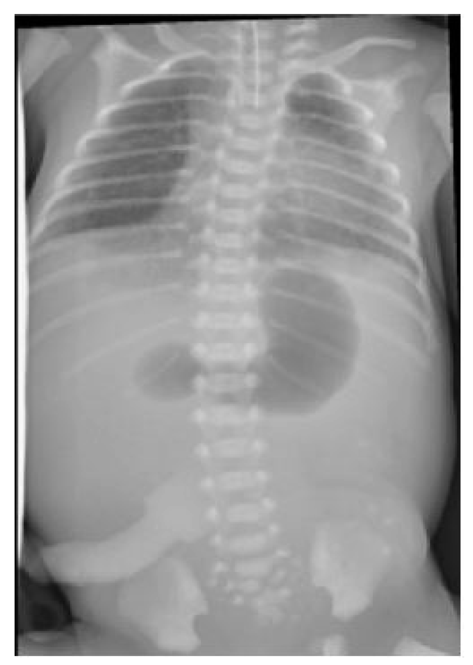 Pediatrrep 13 00026 g002