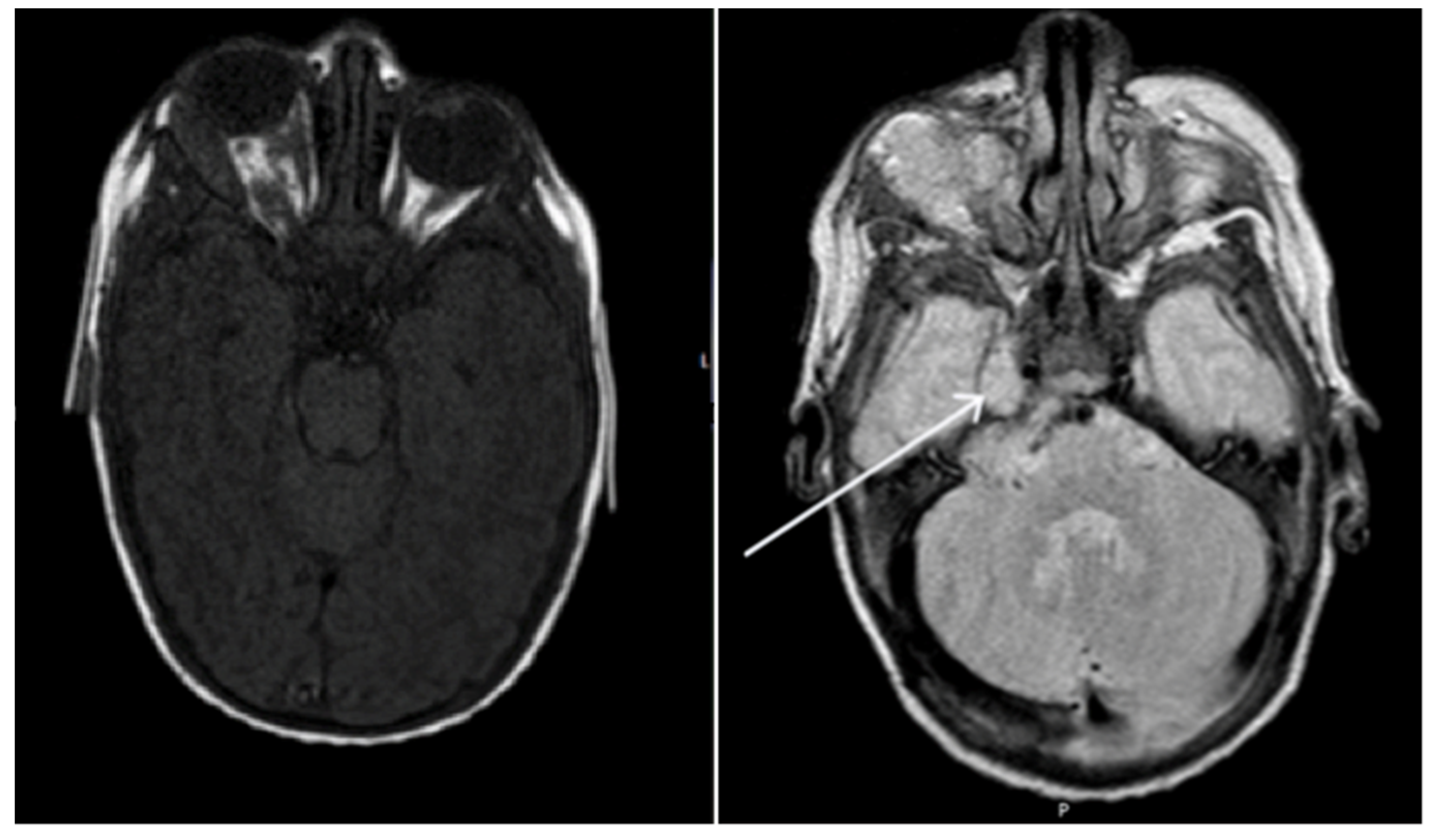 Pediatrrep 13 00043 g002 Pediatrrep 13 00043 g002