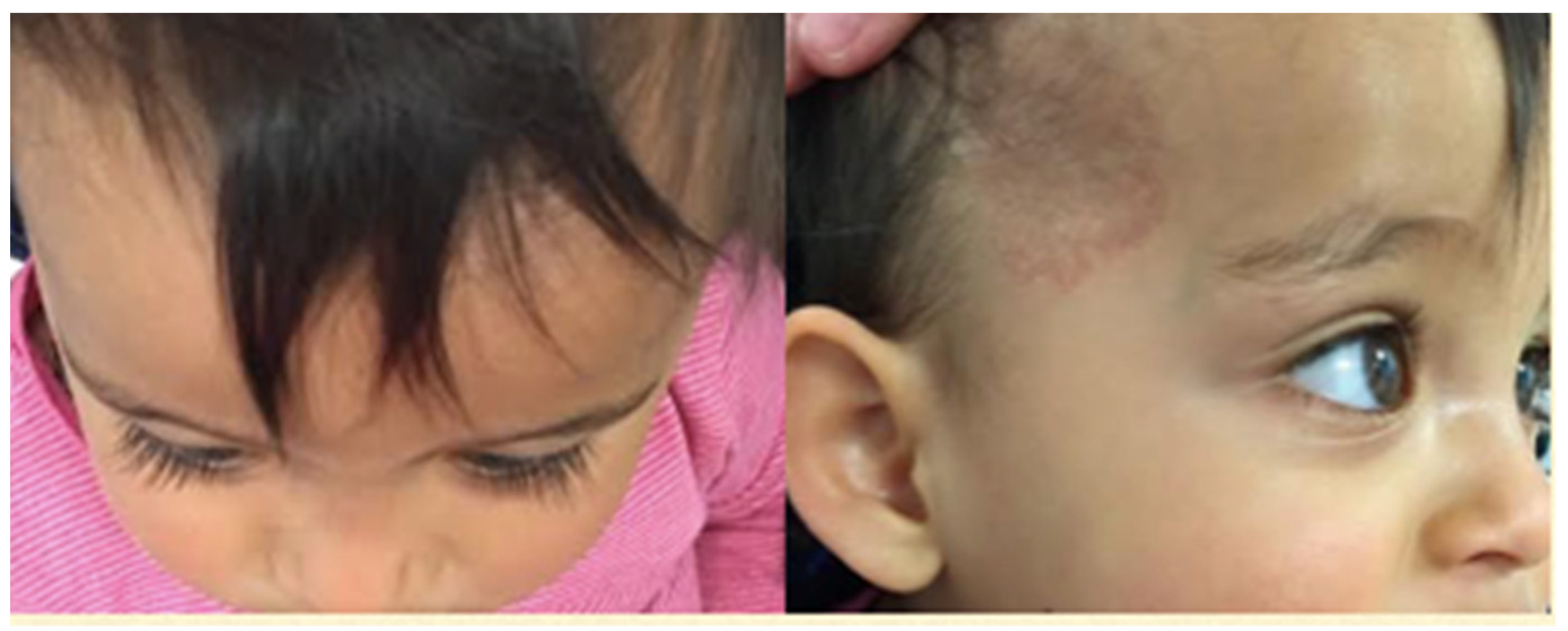 Pediatrrep 13 00043 g003 Pediatrrep 13 00043 g003