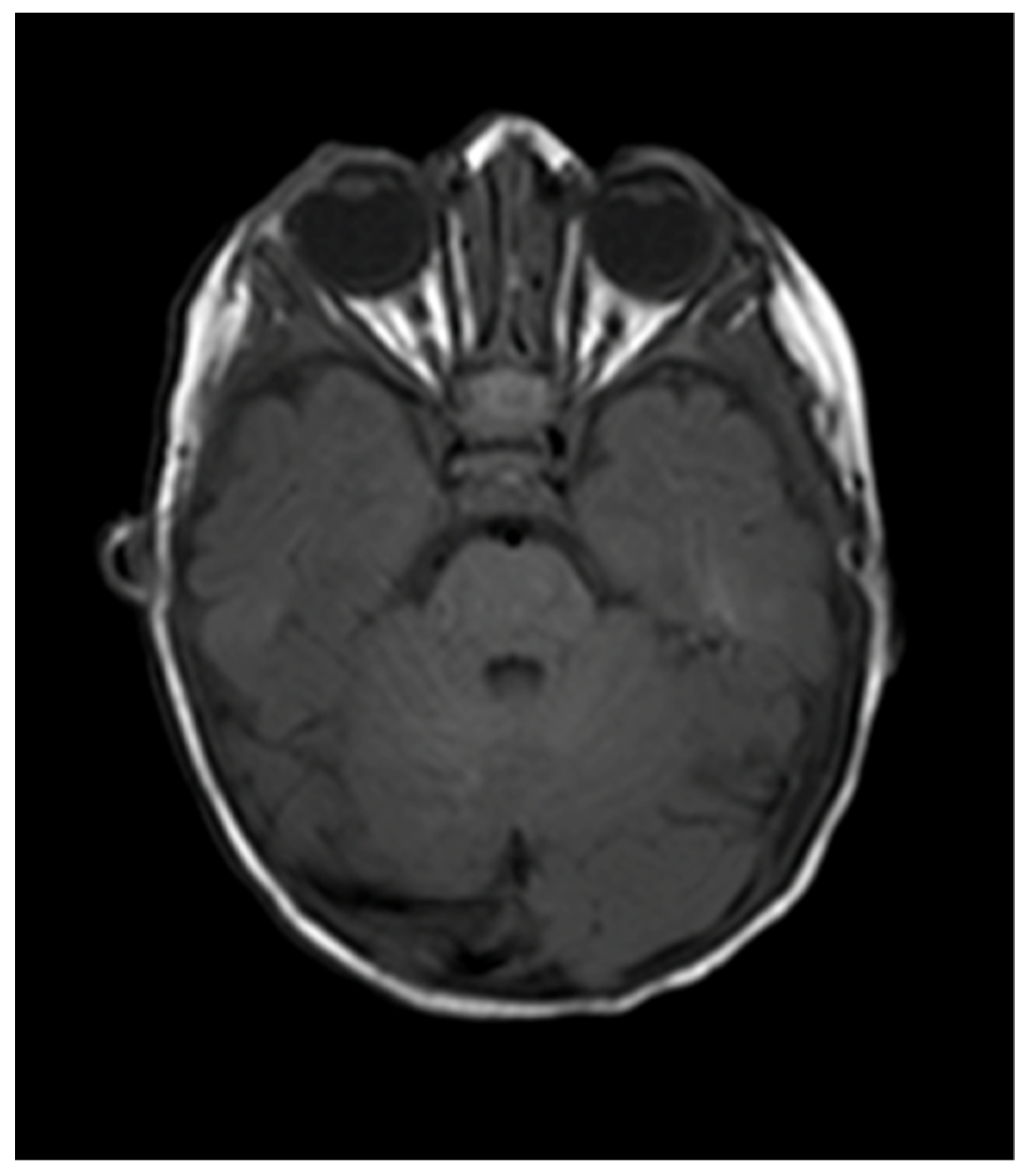 Pediatrrep 13 00043 g004 Pediatrrep 13 00043 g004