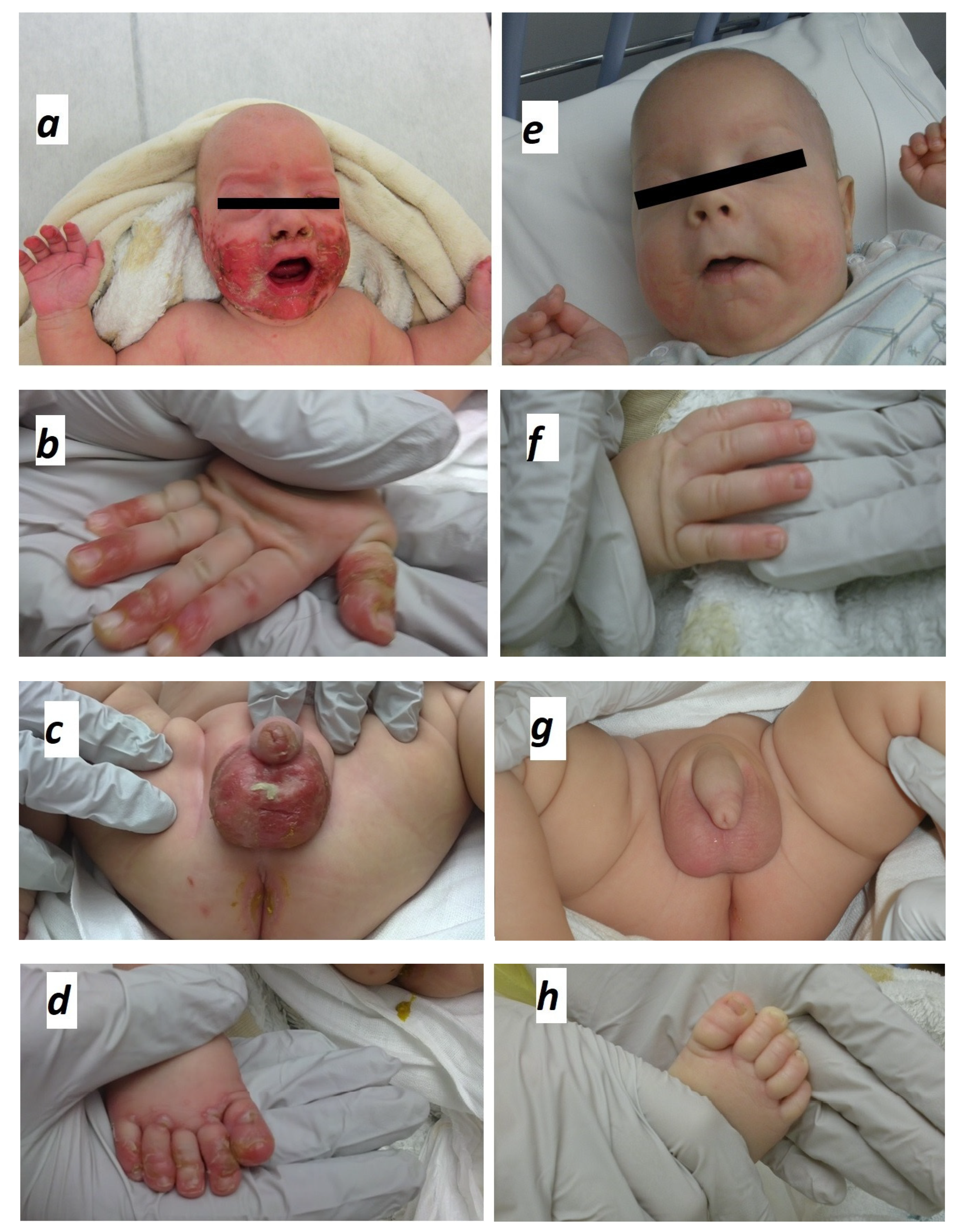 Pediatrrep 13 00051 g001 550