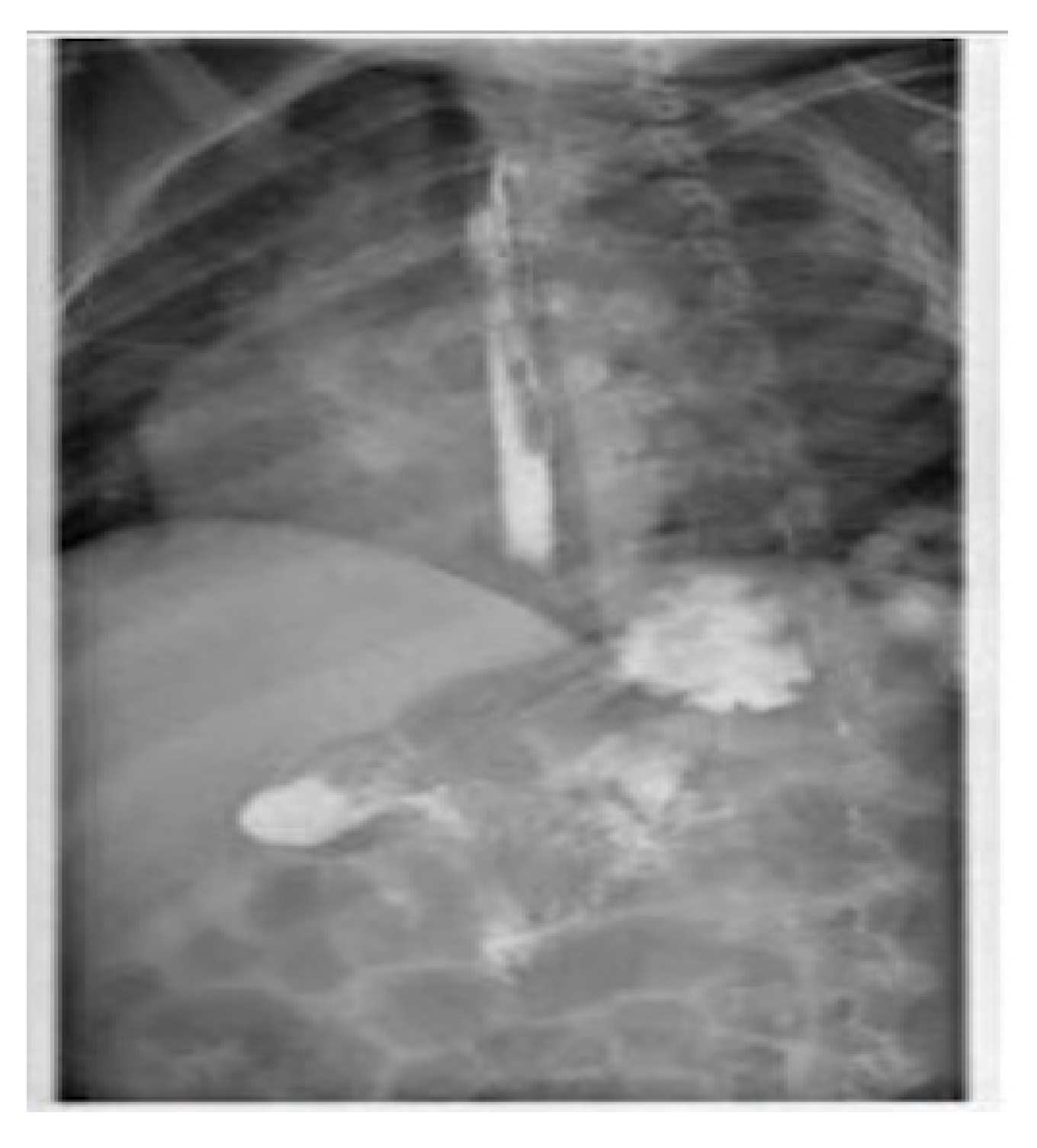 Pediatrrep 13 00059 g004