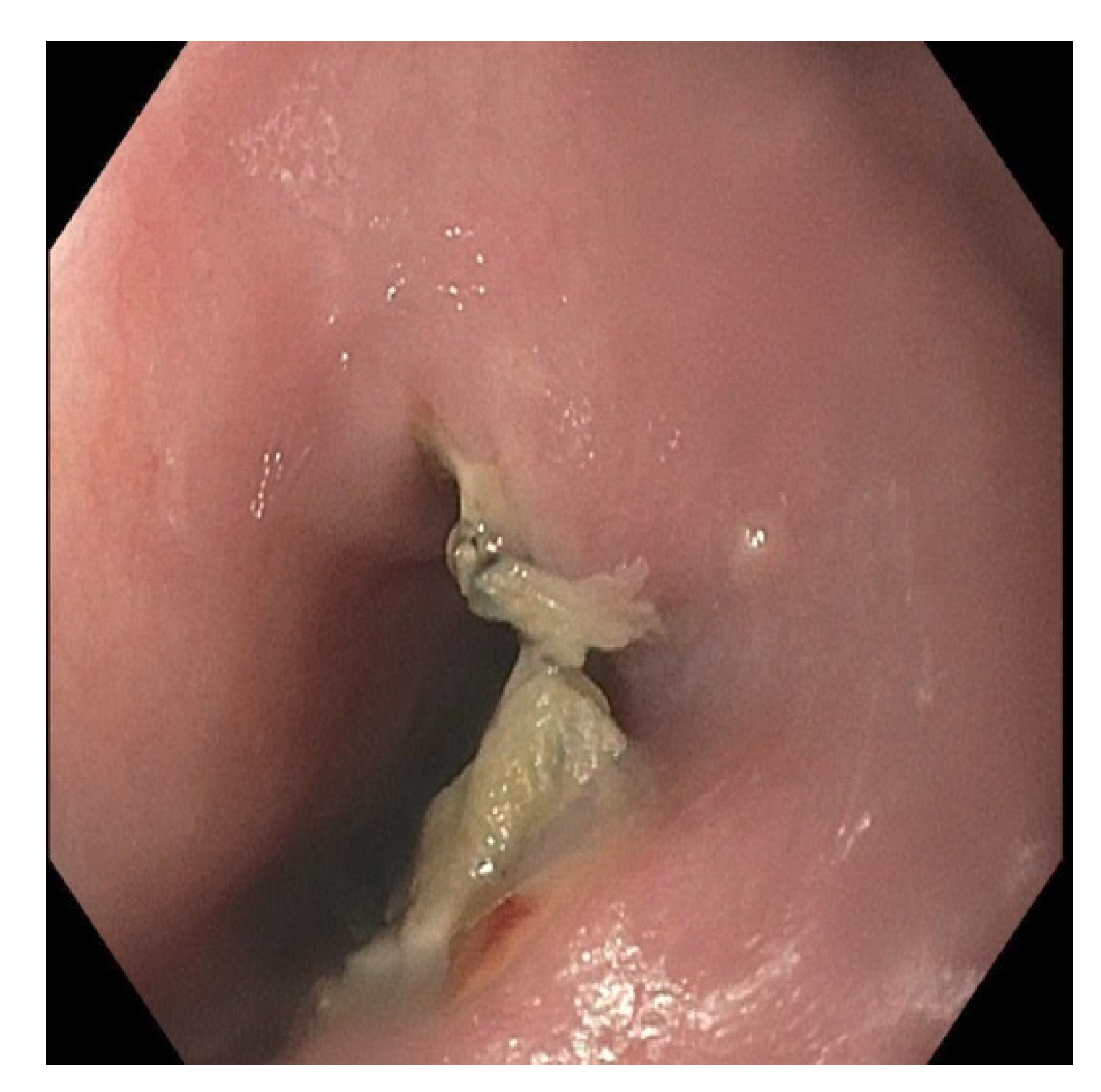 Pediatrrep 13 00059 g005