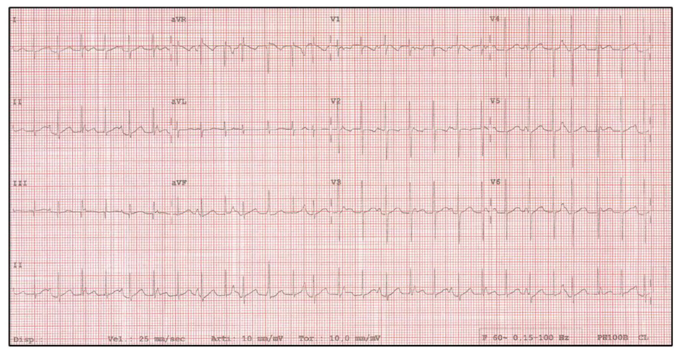 Pediatrrep 13 00074 g001 Pediatrrep 13 00074 g001