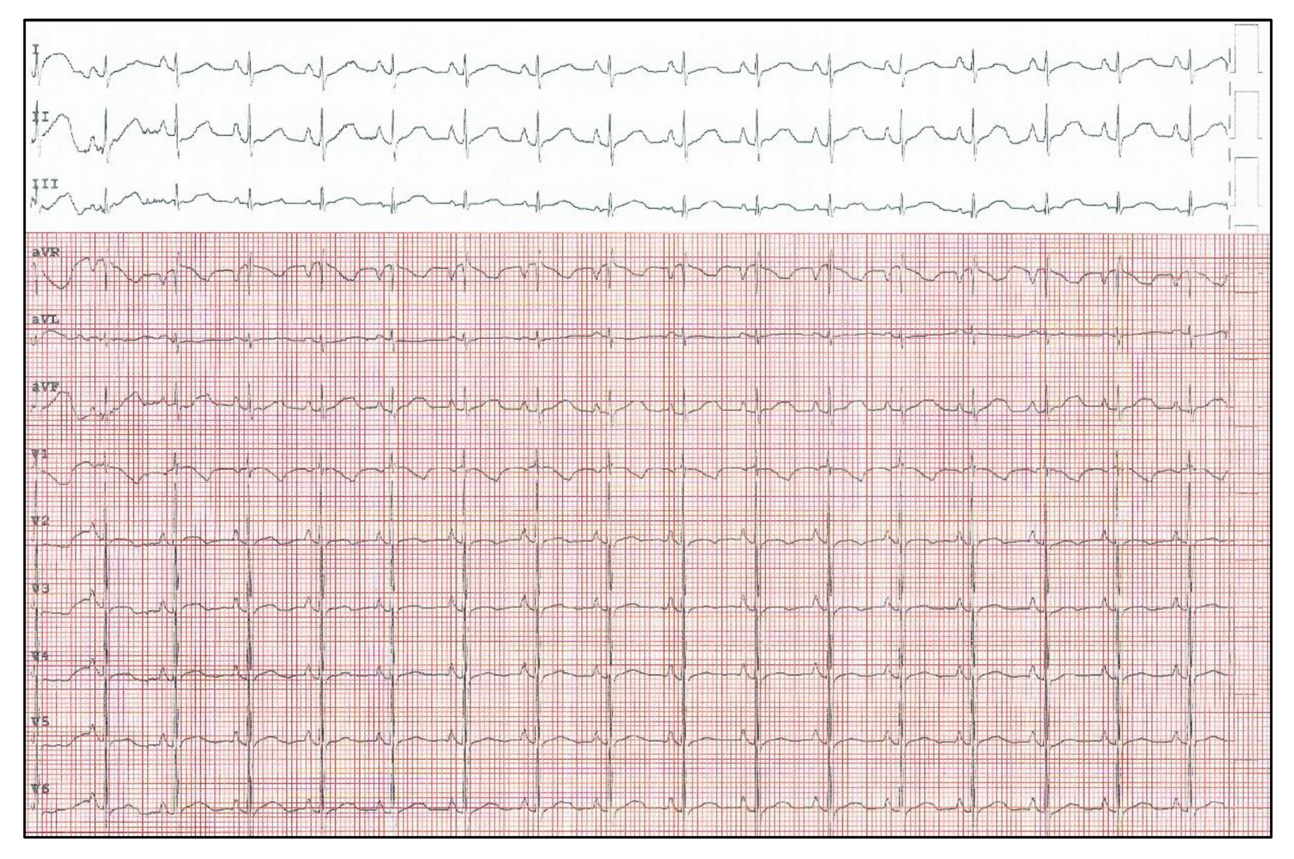 Pediatrrep 13 00074 g002 Pediatrrep 13 00074 g002