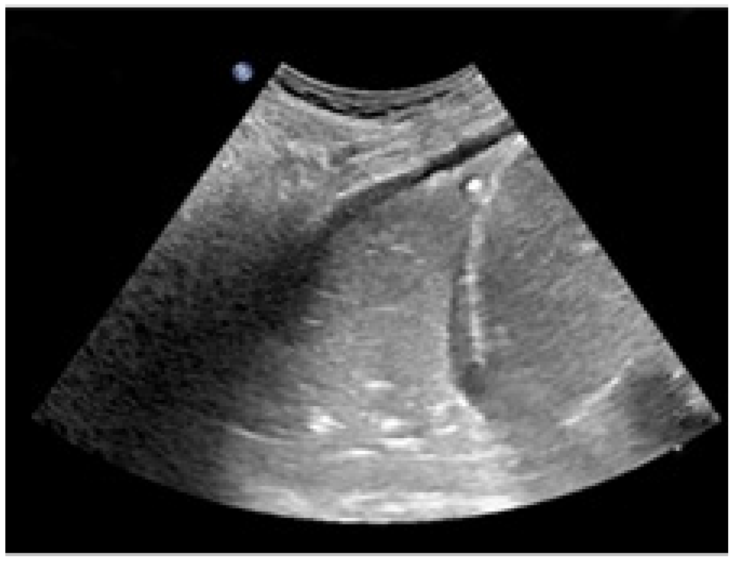 Pediatrrep 14 00012 g001 550