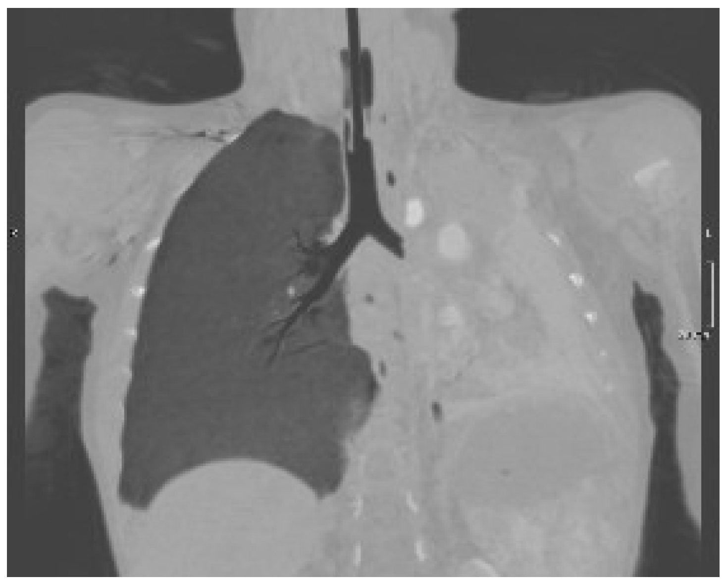 Pediatrrep 14 00012 g002 550