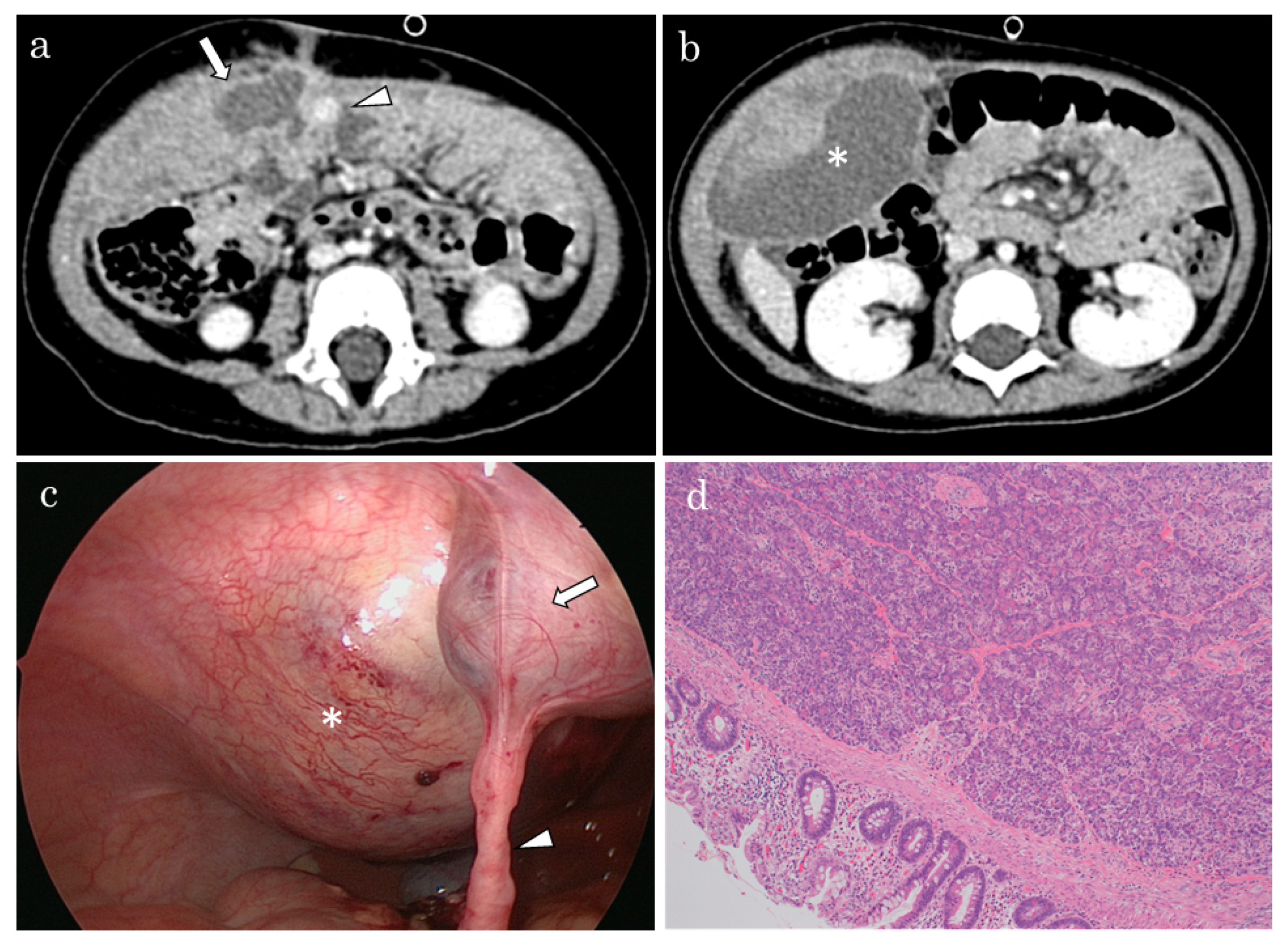 Pediatrrep 14 00018 g001 550
