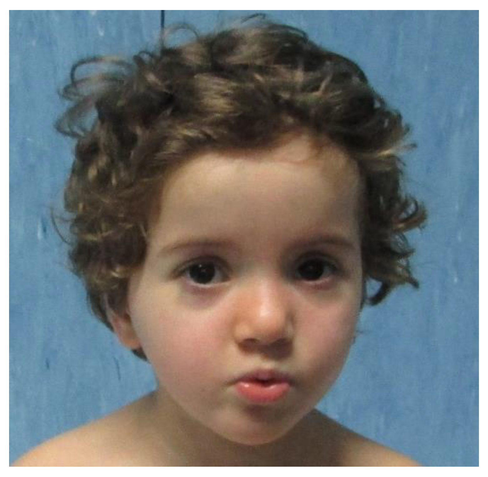 Pediatrrep 14 00019 g001 550