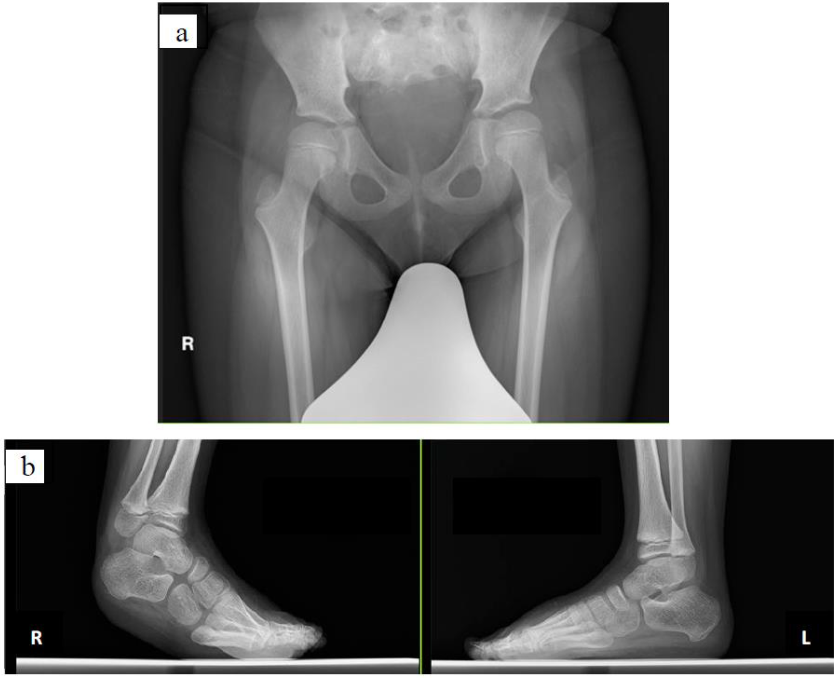 Pediatrrep 14 00041 g002 Pediatrrep 14 00041 g002