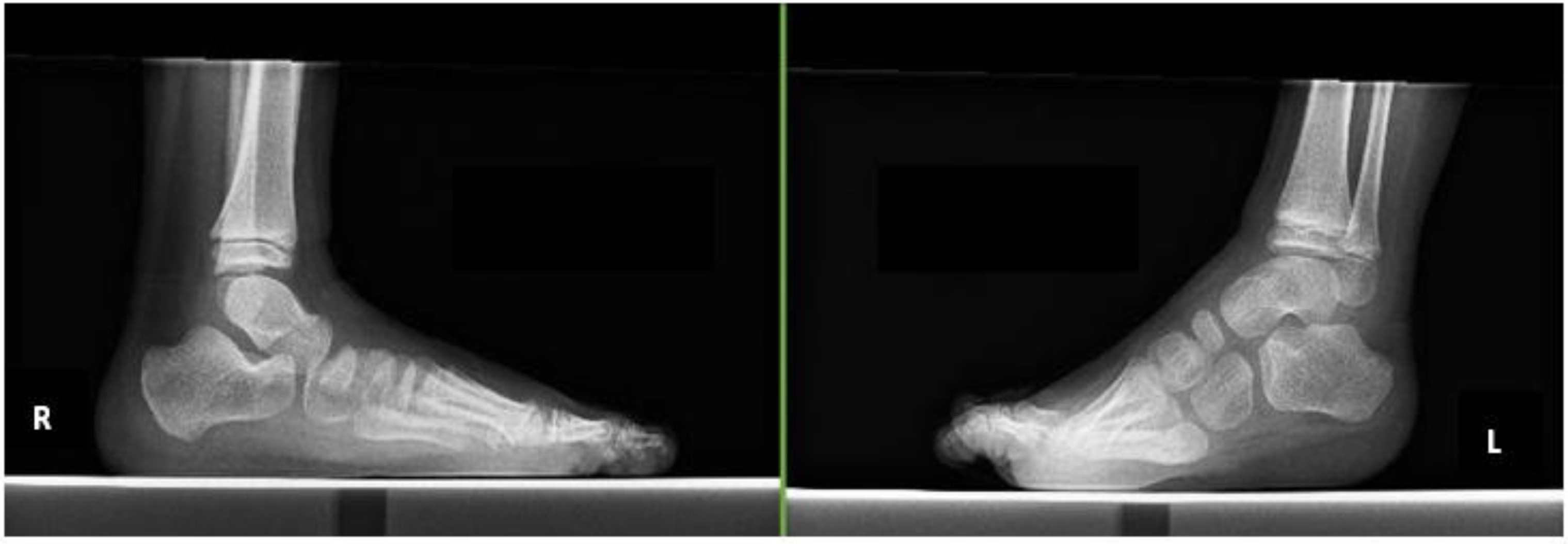 Pediatrrep 14 00041 g003 Pediatrrep 14 00041 g003