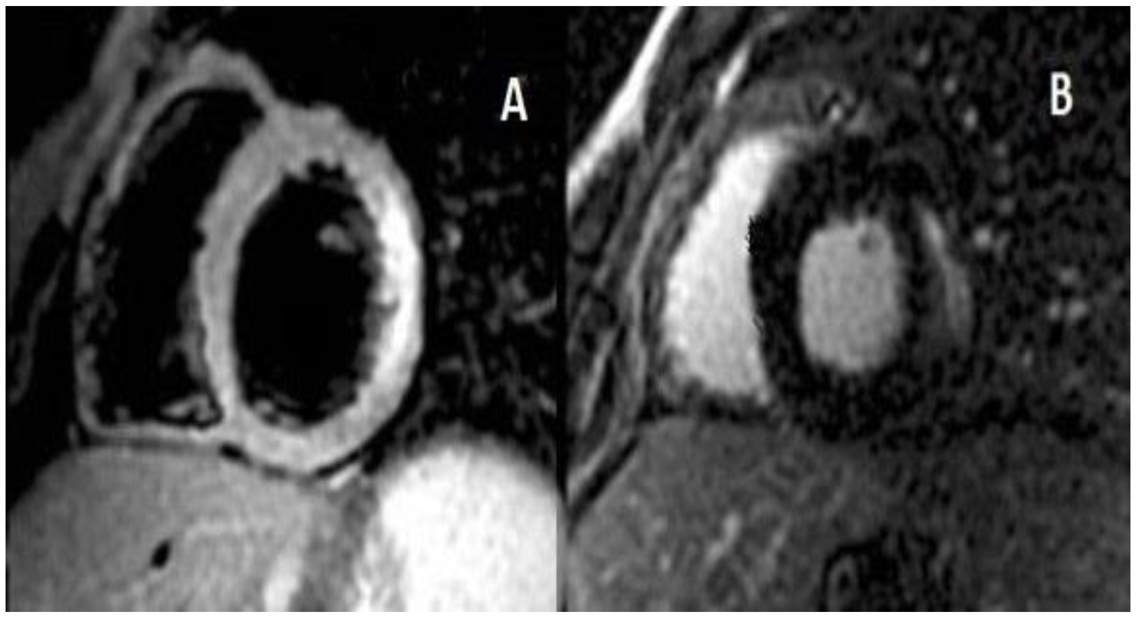 Pediatrrep 14 00048 g002