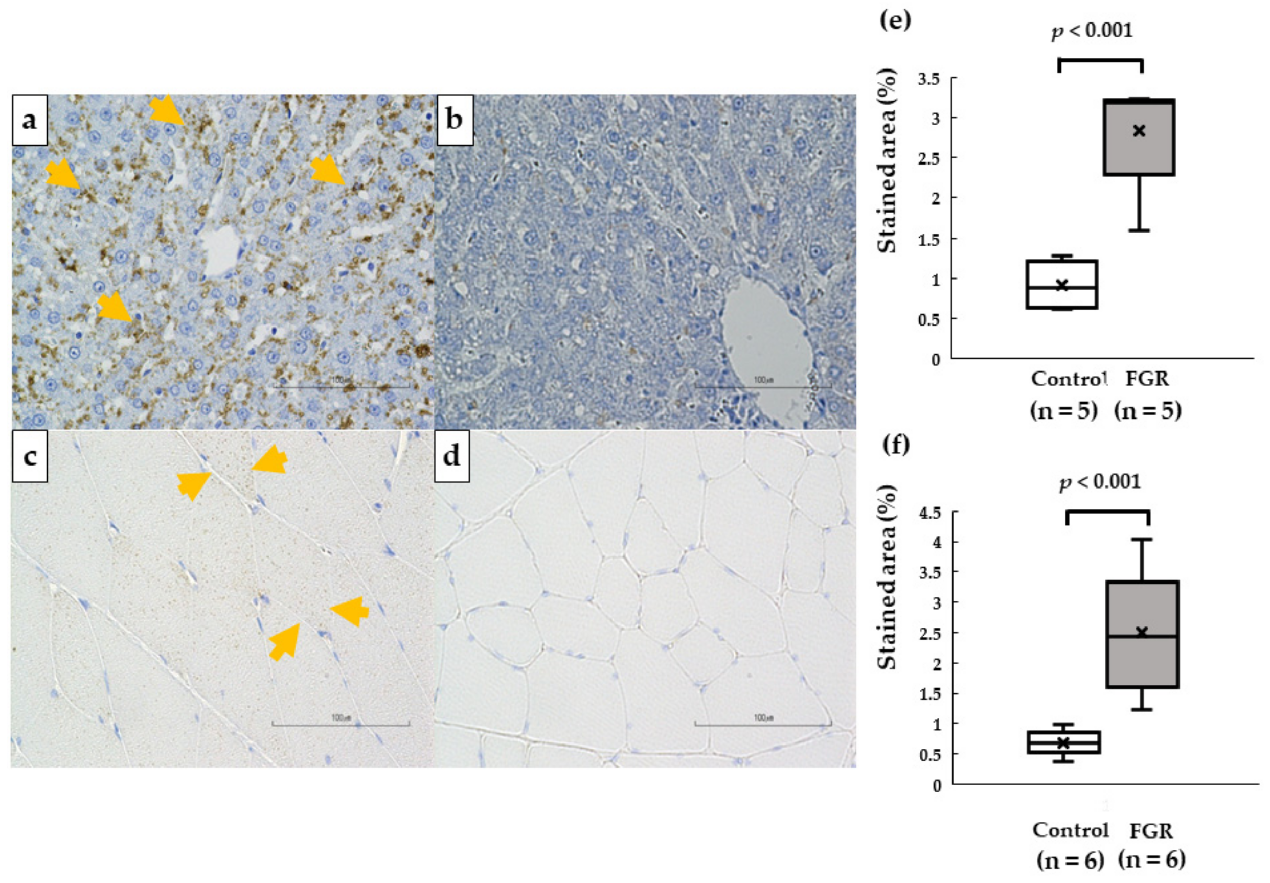 Pediatrrep 15 00006 g006 Pediatrrep 15 00006 g006