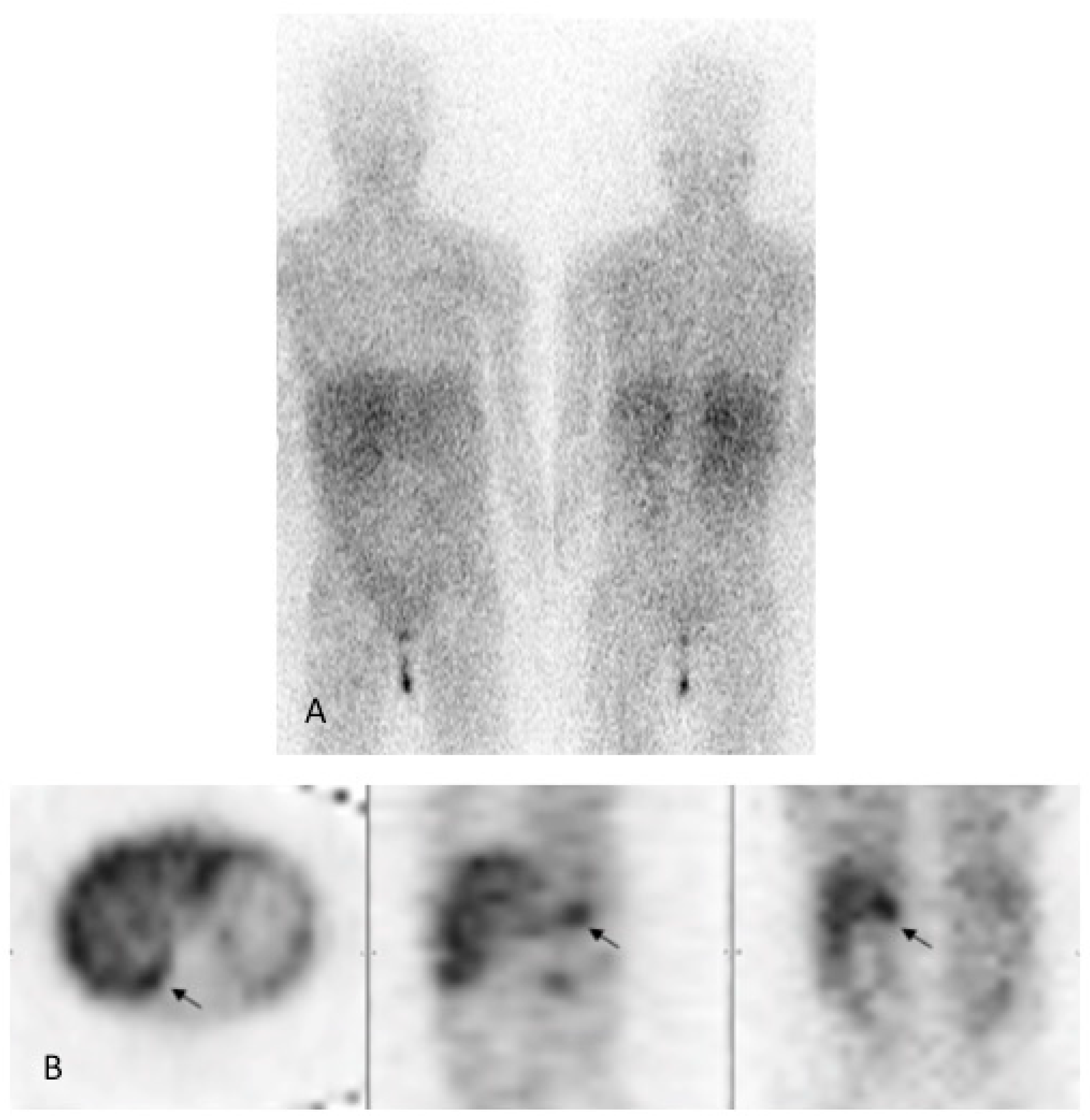 Pediatrrep 15 00019 g004