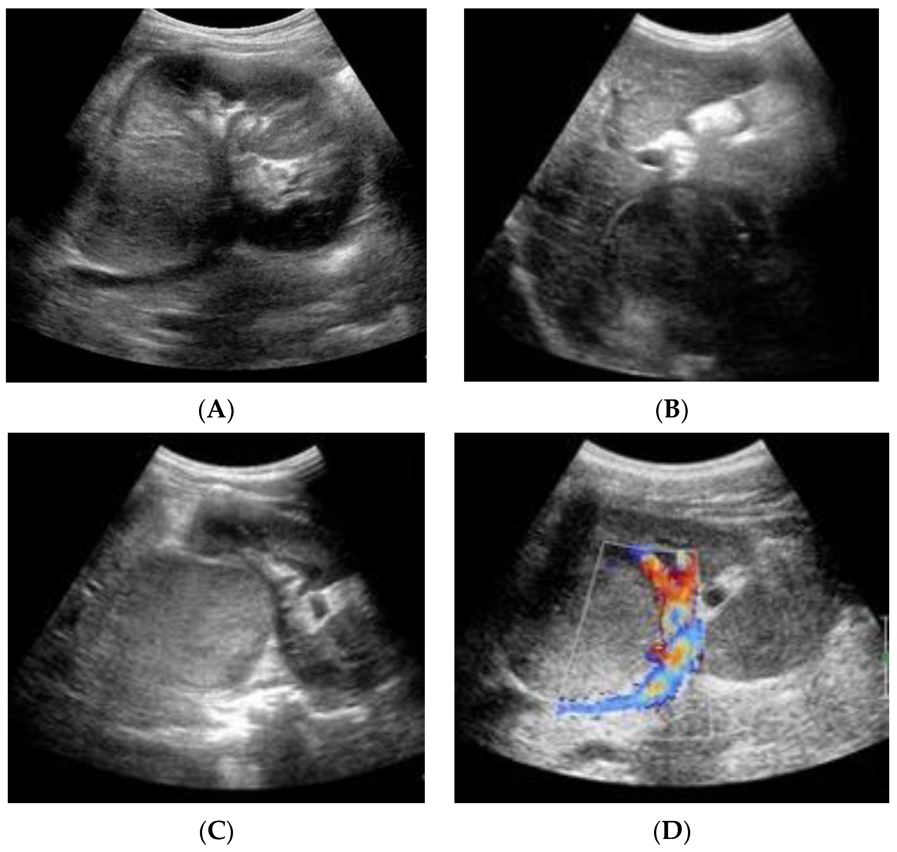 Pediatrrep 15 00051 g001