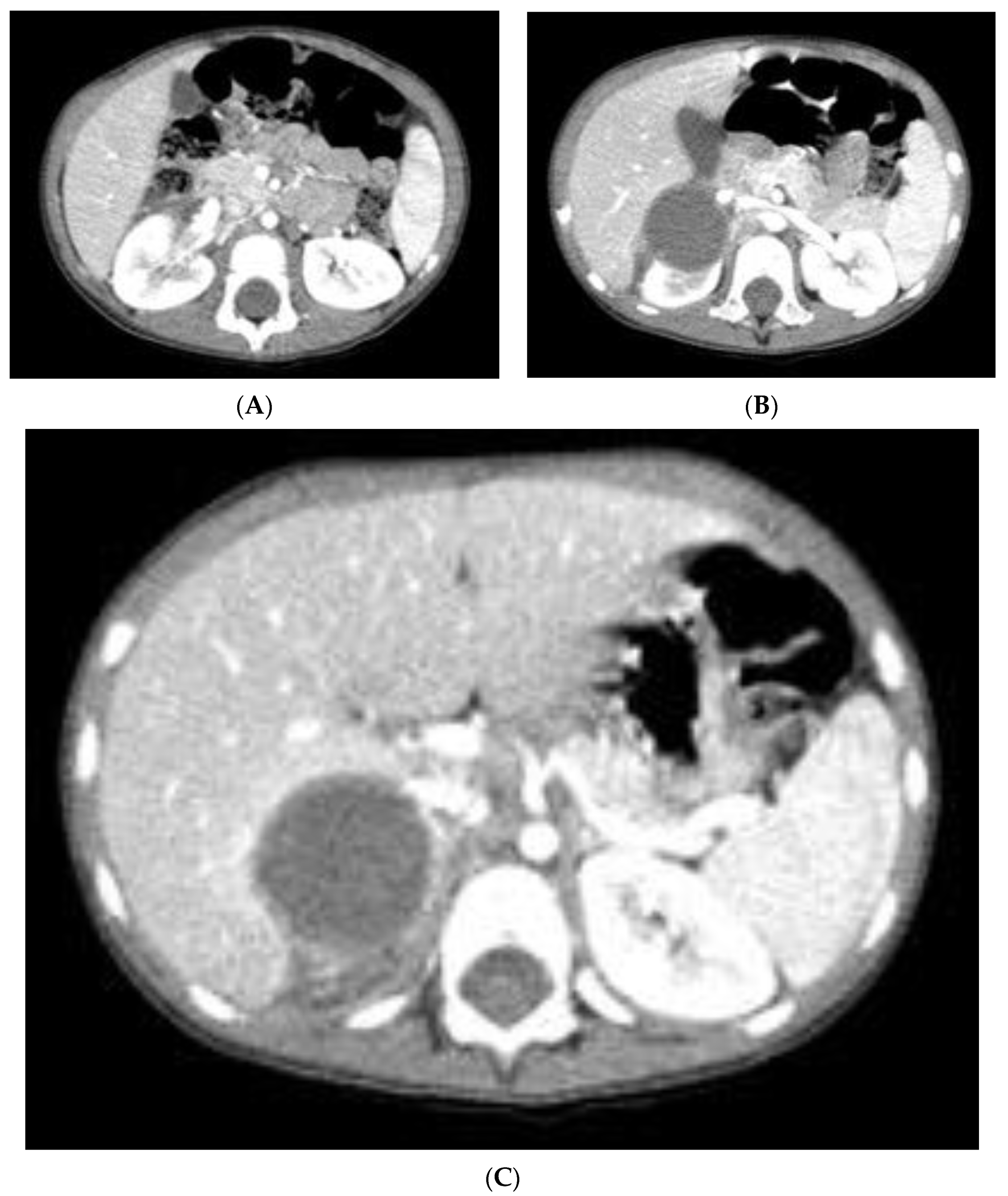 Pediatrrep 15 00051 g002