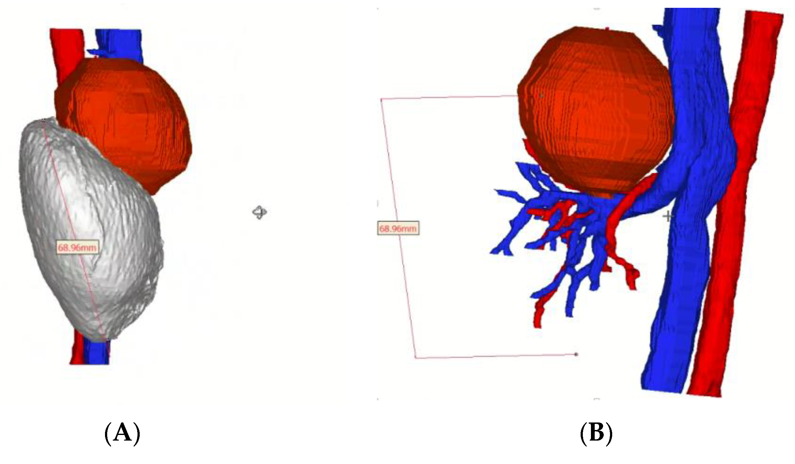 Pediatrrep 15 00051 g004a