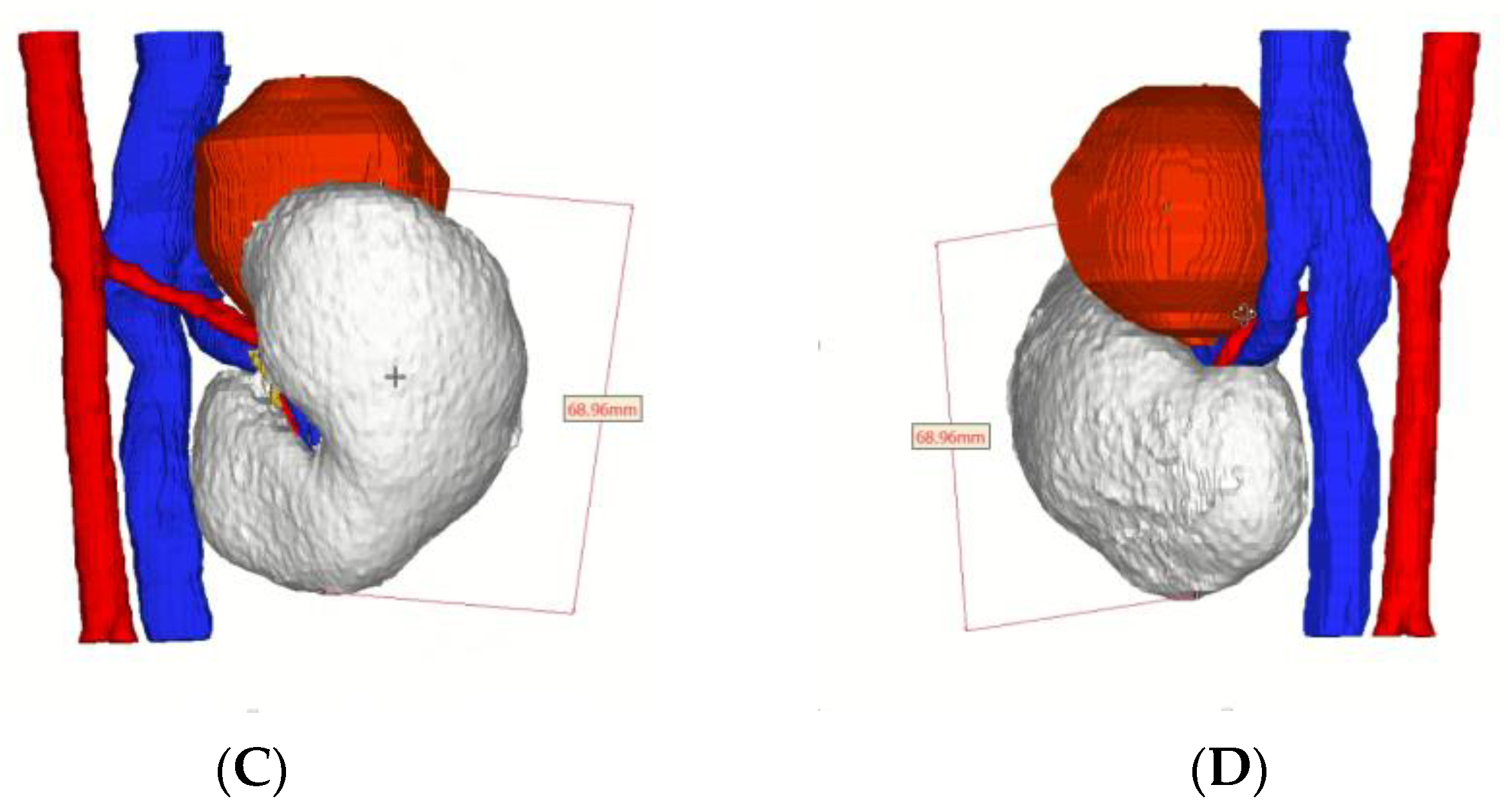 Pediatrrep 15 00051 g004b