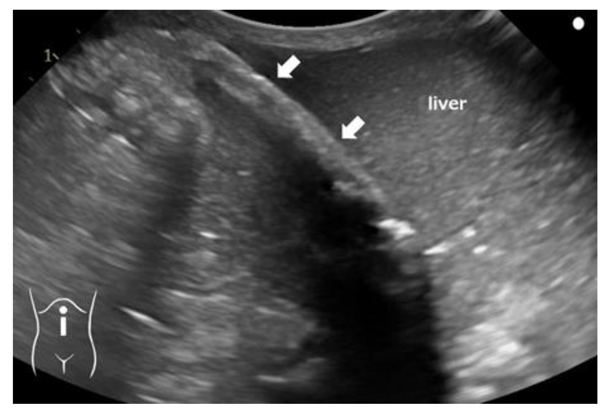 Pediatrrep 16 00007 g003