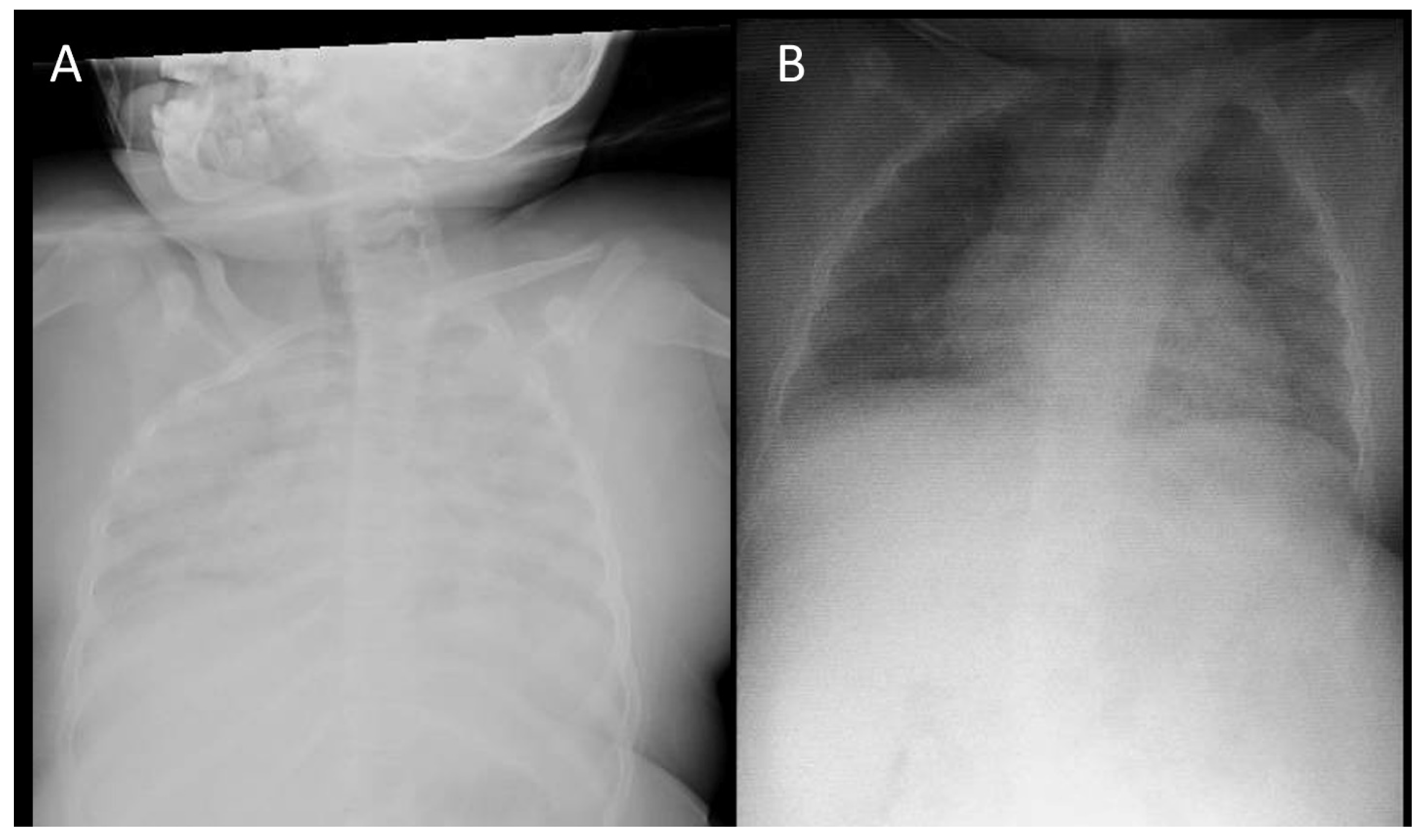 Pediatrrep 16 00023 g002