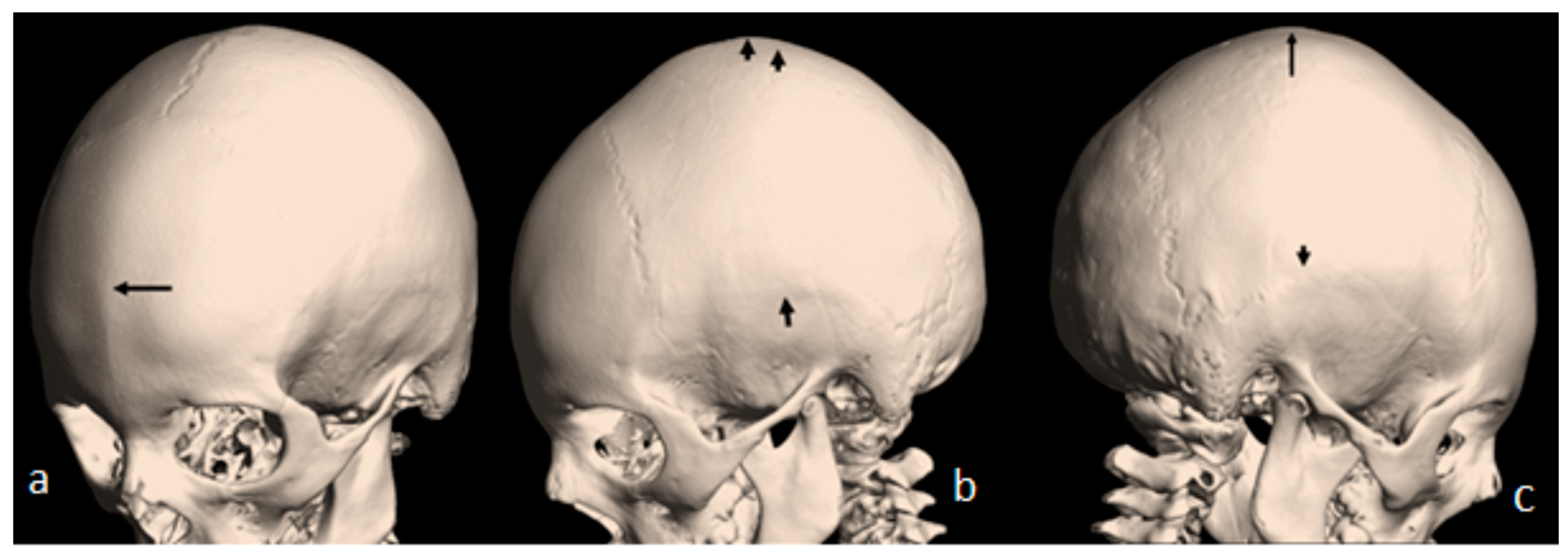 Pediatrrep 16 00035 g002