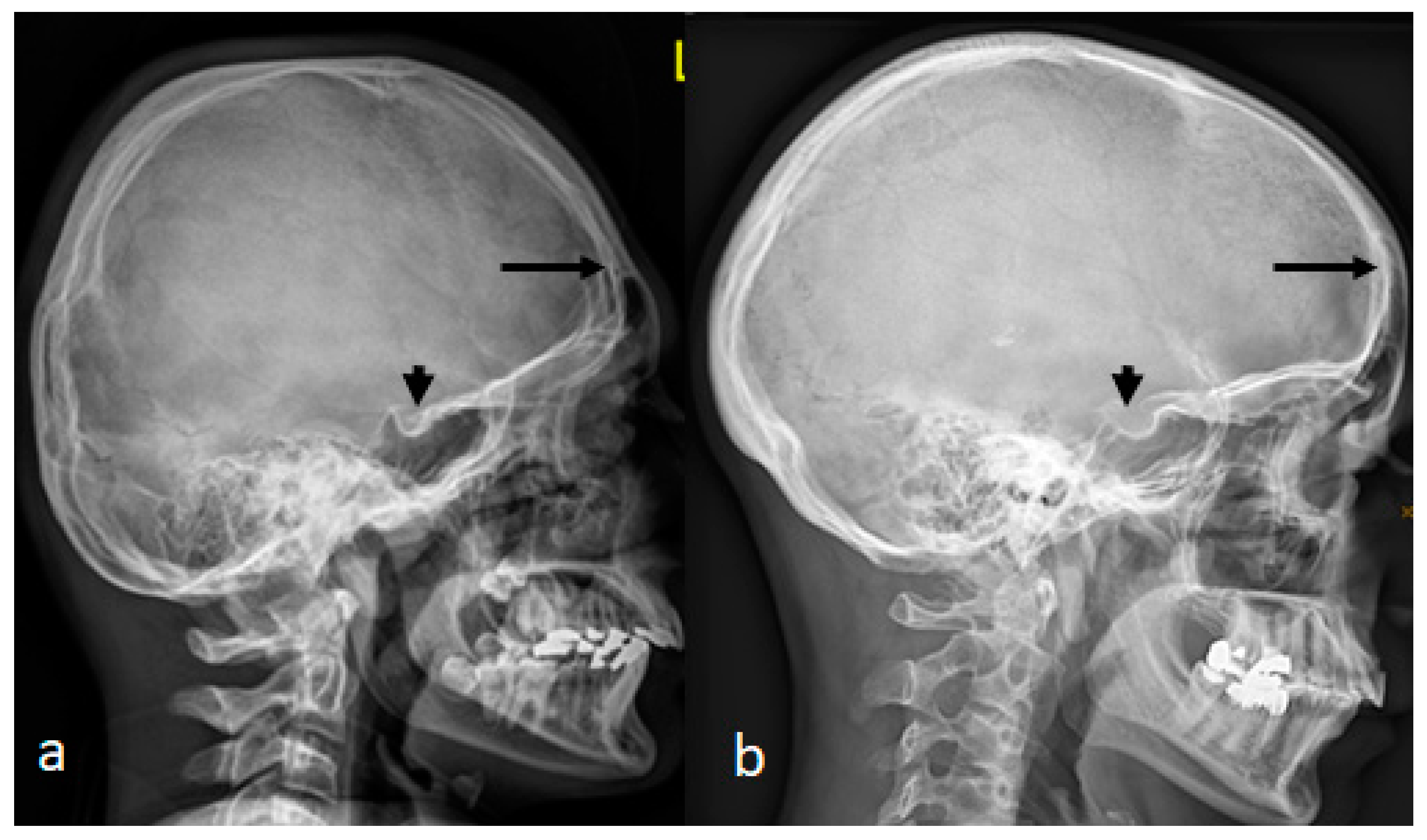 Pediatrrep 16 00035 g004