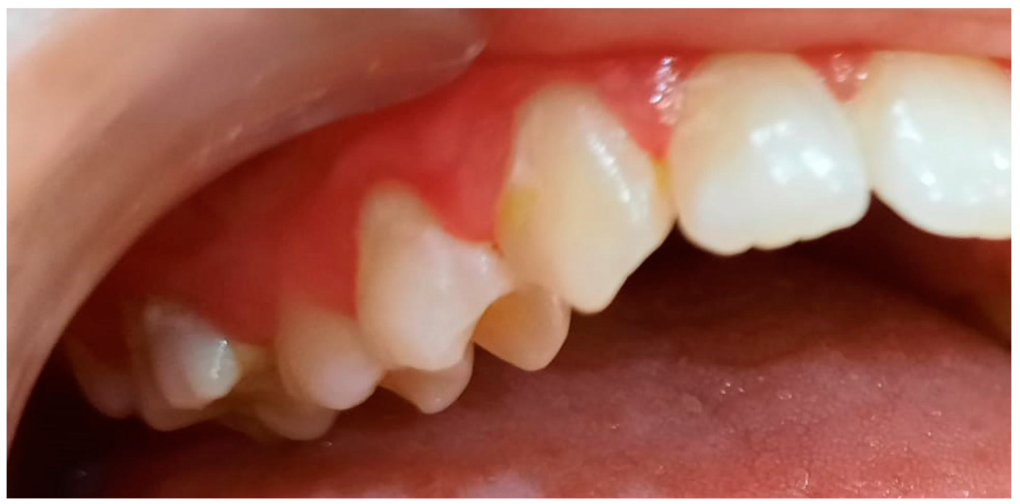 Pediatrrep 16 00041 g013