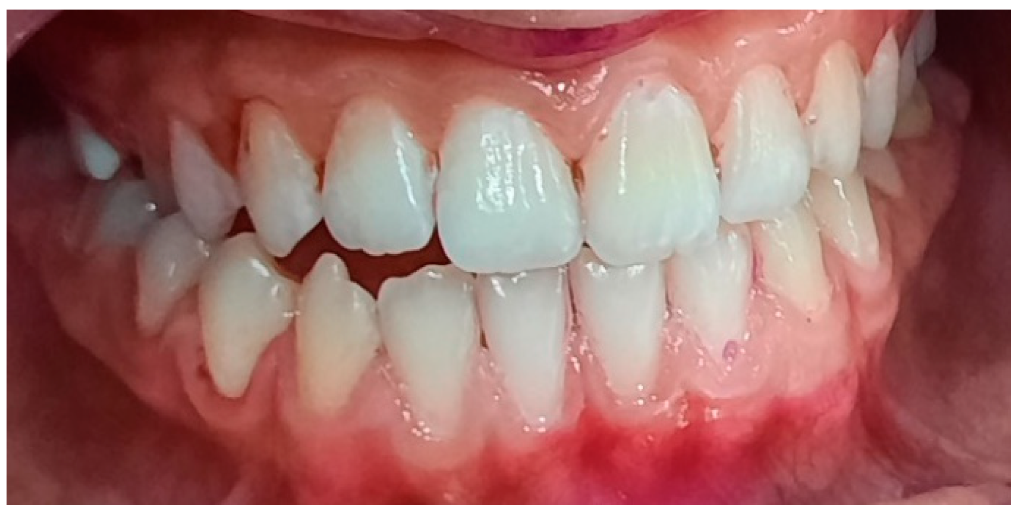 Pediatrrep 16 00041 g014