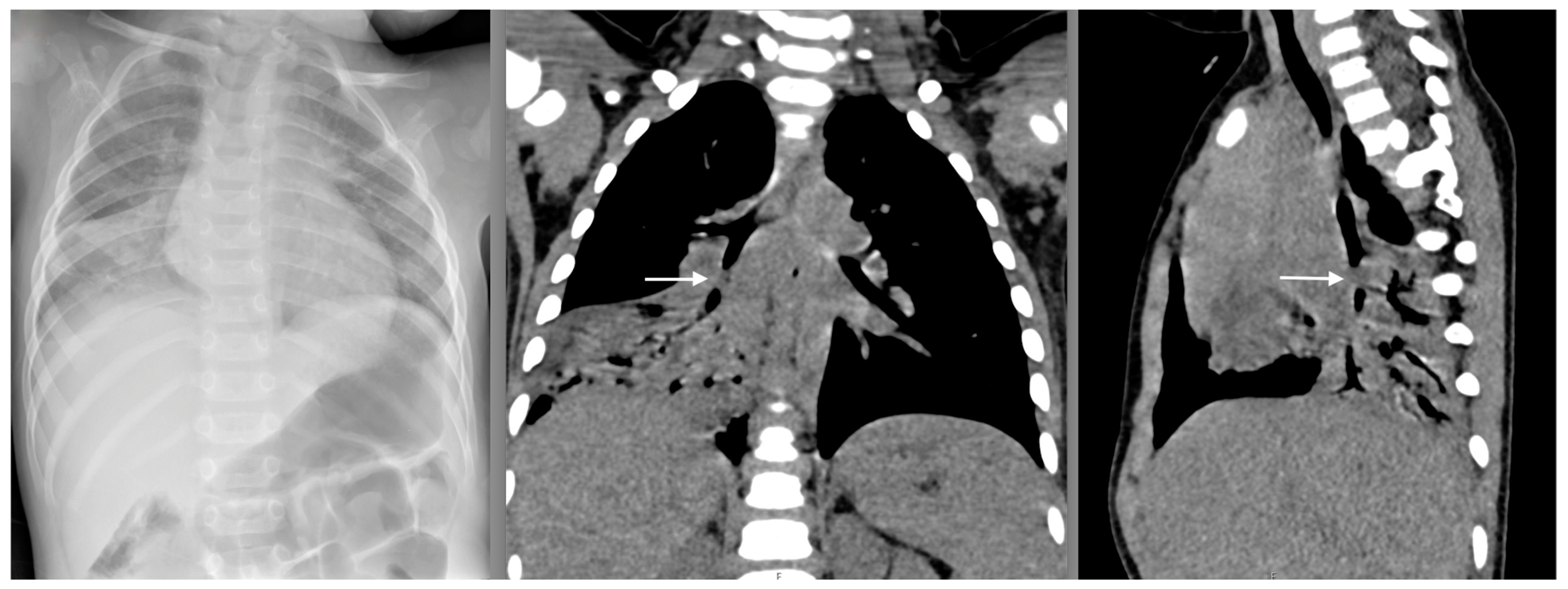 Pediatrrep 16 00042 g004