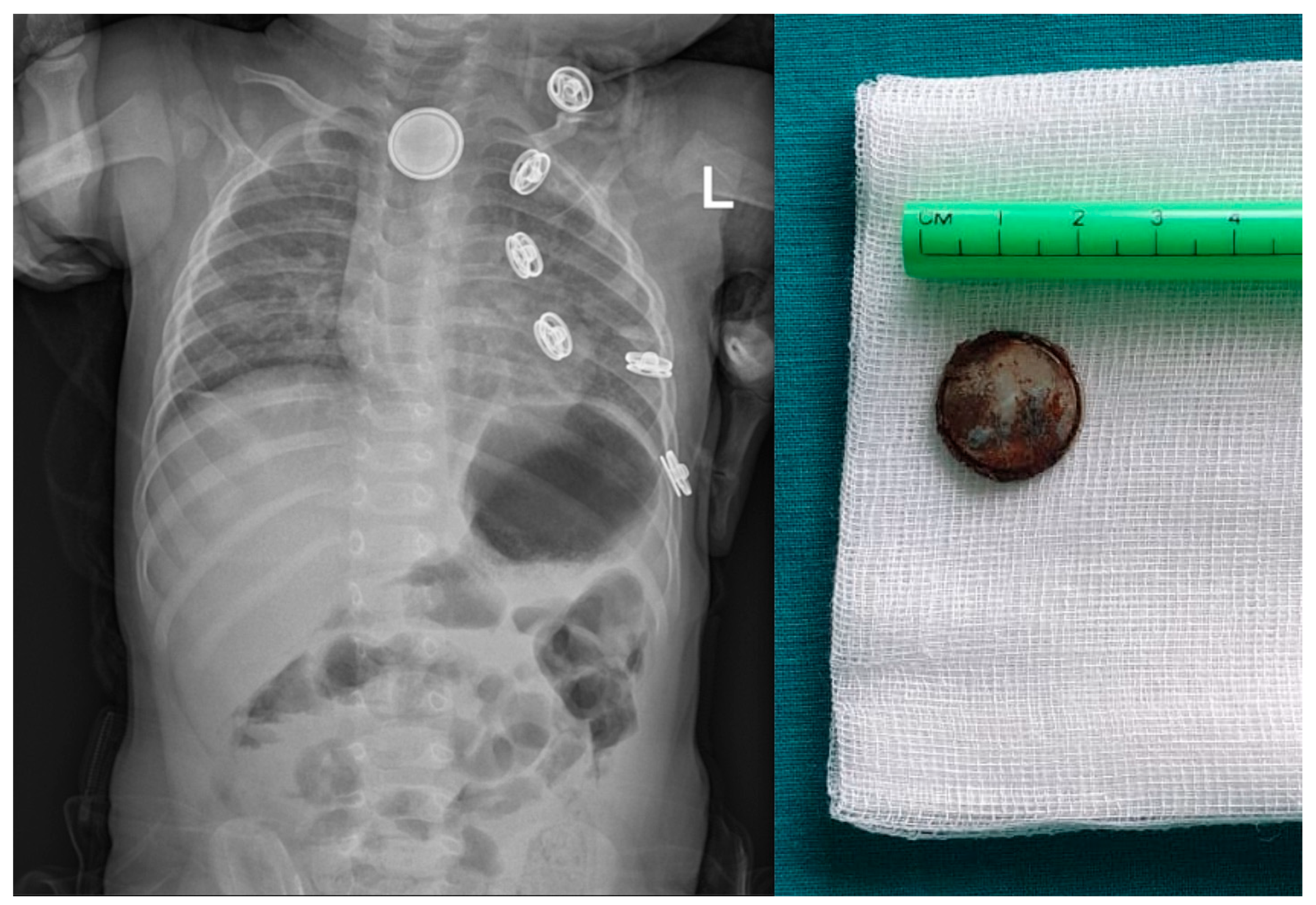 Pediatrrep 16 00042 g006